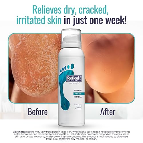 Miniatura 3 de FOOTLOGIX DD Cream Mousse, blanco, 4.23 onzas