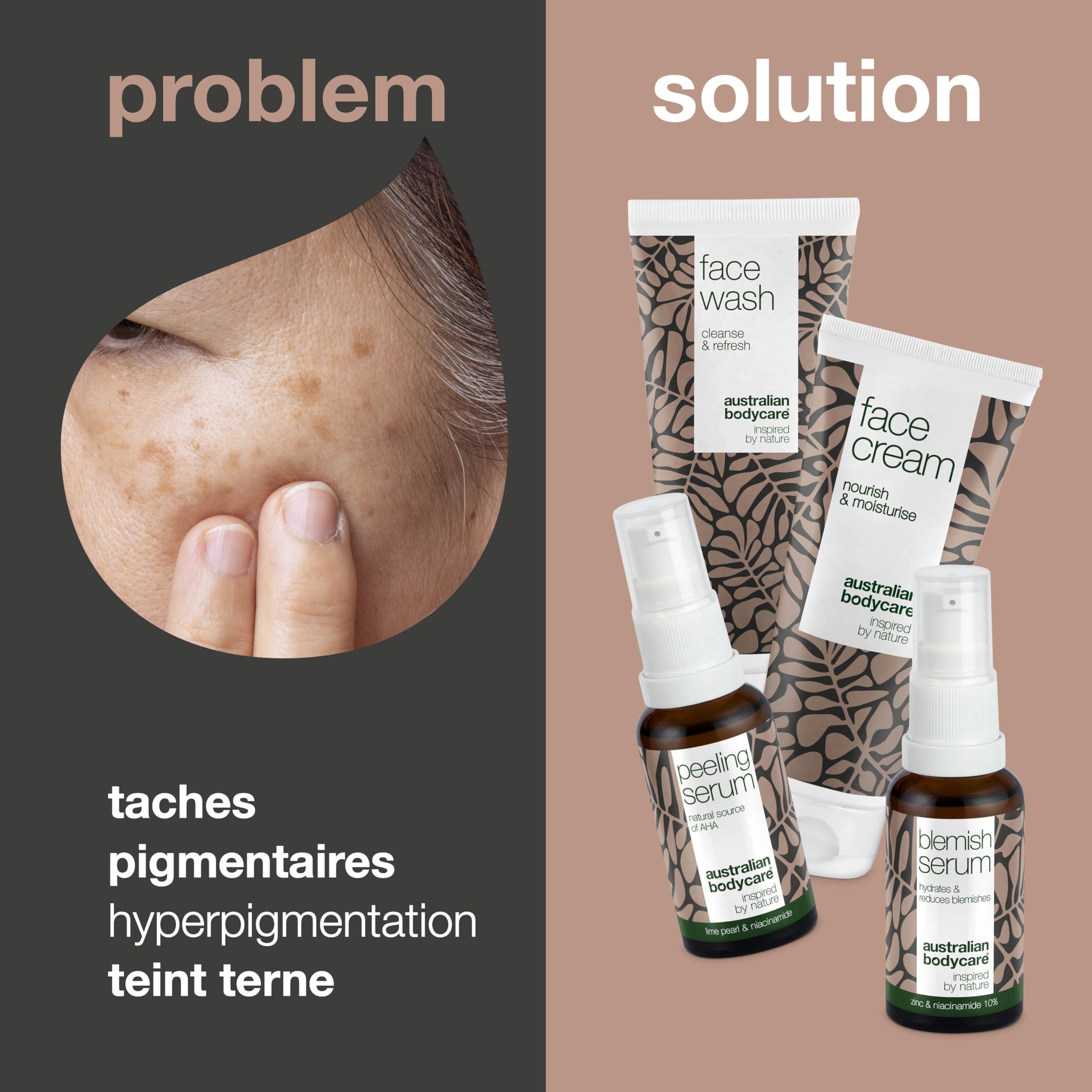 Réduisez les problèmes de pigmentation sur le visage avec un ensemble de 4 pièces composé d'un nettoyant pour le visage, d'un sérum de niacinamide, d'un sérum peeling et d'une crème pour le visage