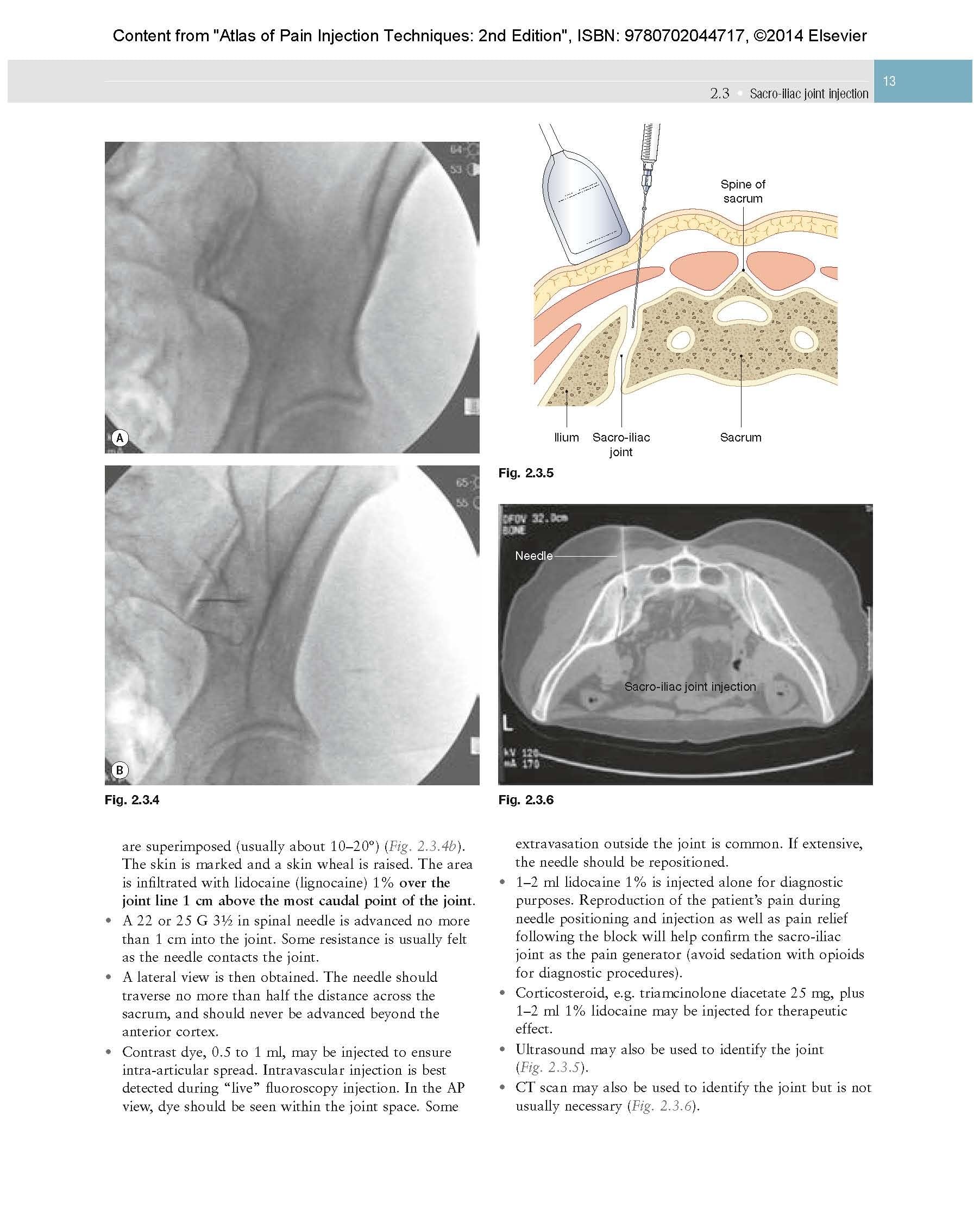 Atlas of Pain Injection Techniques: Expert Consult: Online and Print