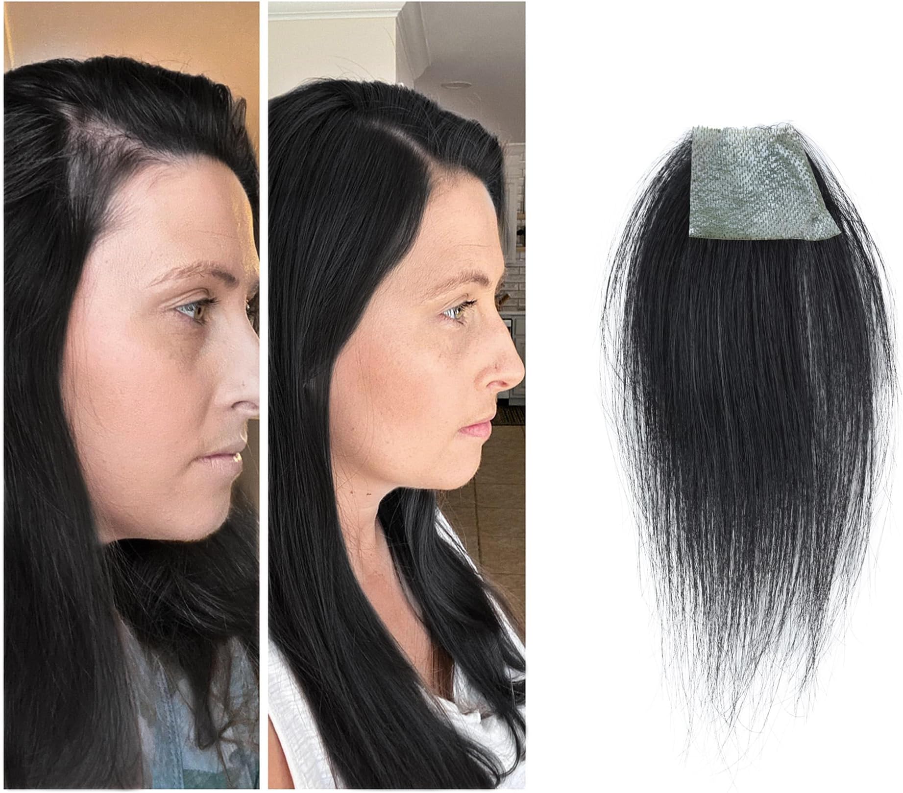 scar human hair replacement Accidental burns without hair for men women Hairline Loss Straight Tape in Replacement Toupee (Jet Black, 1.57"x1.57")