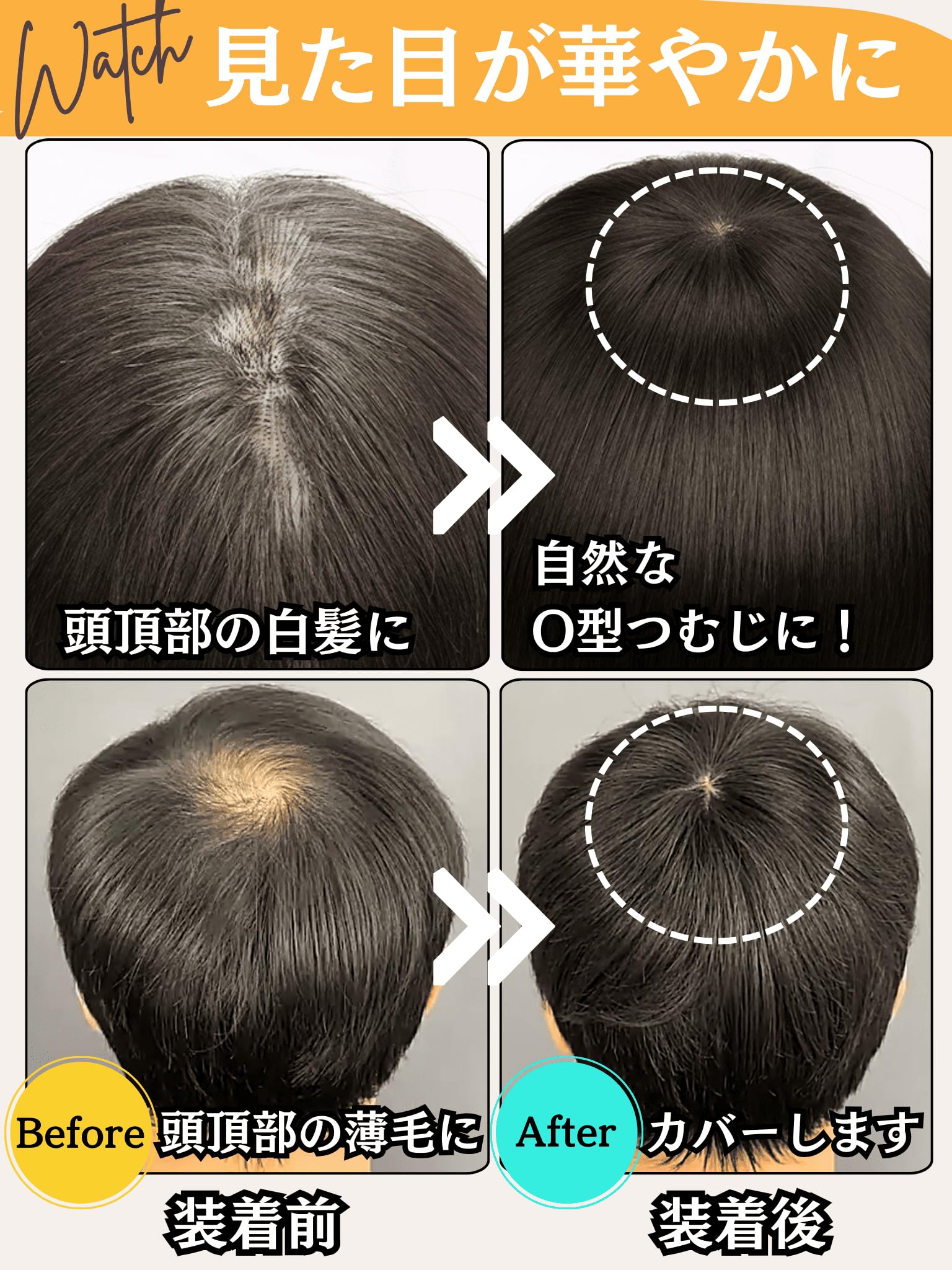 Amazon.co.jp: Luce brillare 部分ウィッグ つむじ 頭頂部 人毛 医療用