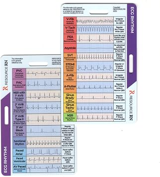 EKG Rhythm Interpretation Badge Card Quick Reference Guide for ECG/EKG Rhythms Dual-Sided, Horizontal & Vertical Layout Pocket-Sized Cheat Sheet for Nurses, Paramedics & Medical Students