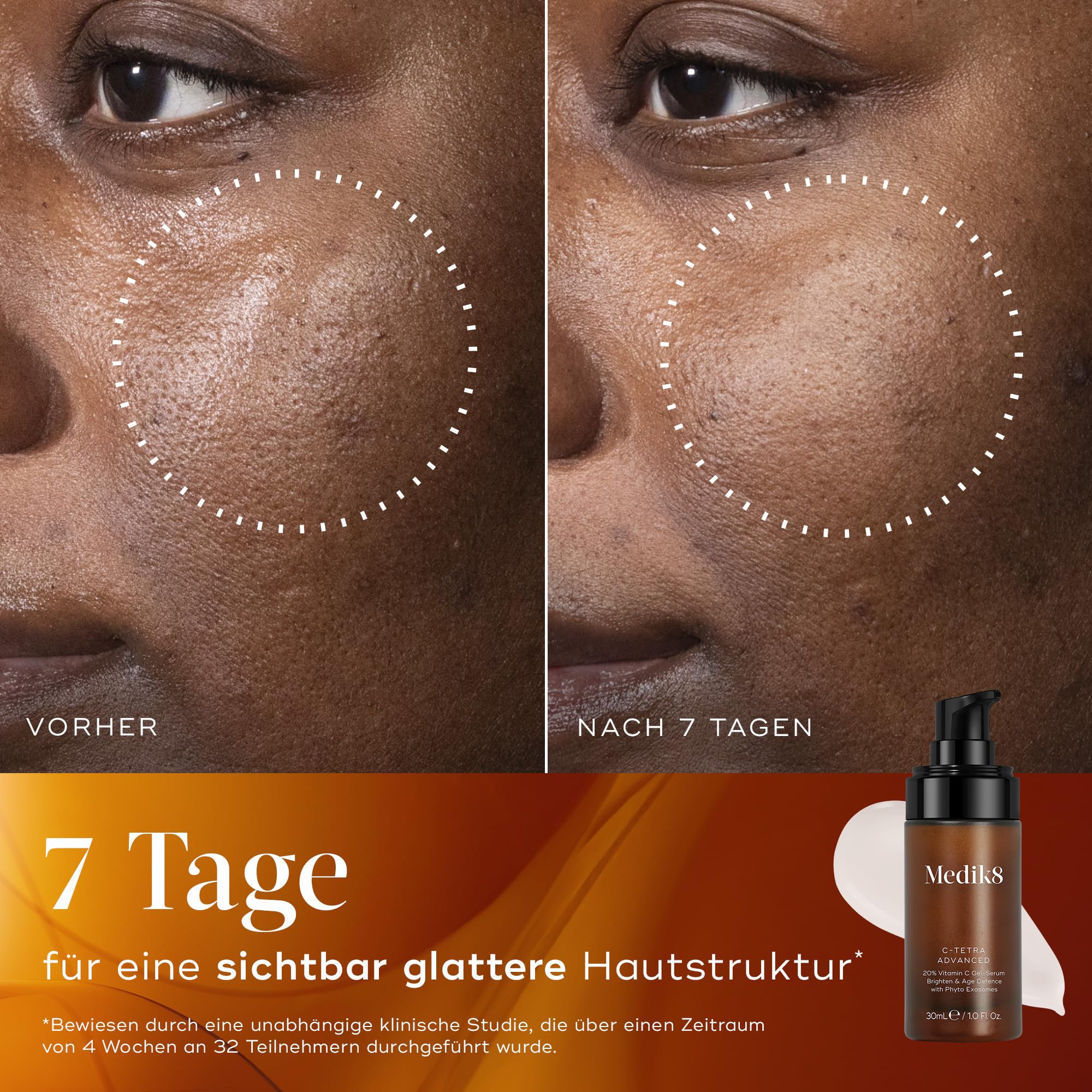 Medik8 C-Tetra Advanced, 20% Vitamin C Gel-Serum mit Exosomen - 30 ml | Vitamin-C-Serum mit Exosomen – schützt vor vorzeitiger Hautalterung und sorgt für eine beschleunigte Aufhellung des Hautbilds