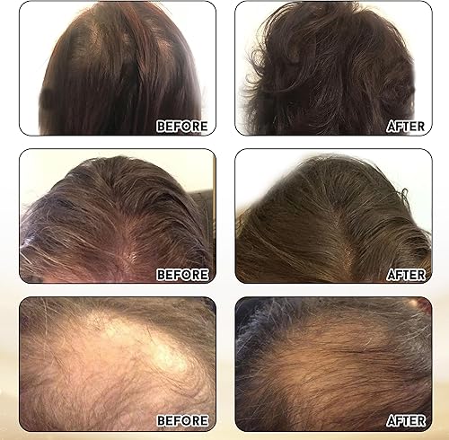 Miniatura 6 de Joyce Giraud Ultimate - Suplementos para fortalecer el cabello, suministro para 60 días, formulado científicamente para reducir la pérdida de