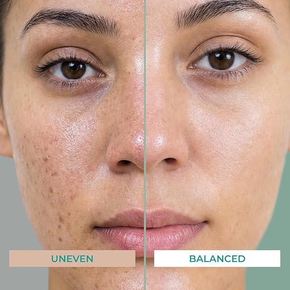 PatchRx Glycolic Acid Pads 20% Glycolic & Salicylic Acid Face Pads Exfoliating Chemical Peel Toner for Acne Treatment Glycolic Acid Peel Face Exfoliant, 75 Pads