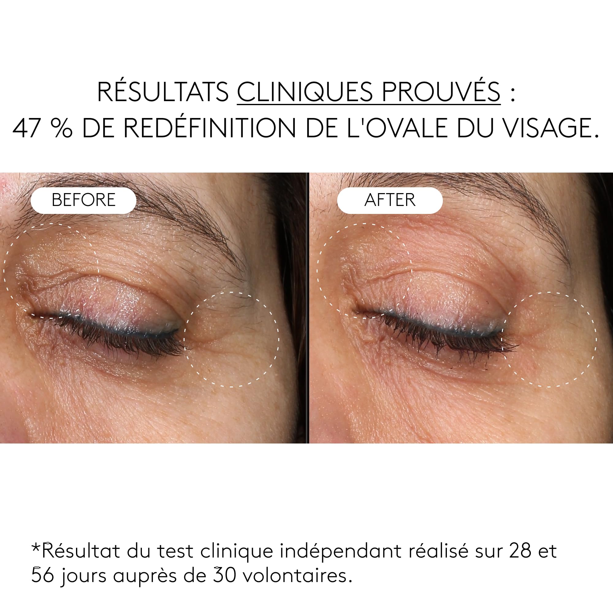 COCUNAT Clinical Exosomes Siero Viso Antirughe Esosomi V-Lifting 30 ml | Siero antietà ad azione rassodante. Elimina le rughe, restituisce elasticità e ridefinisce l'ovale del viso in 8 settimane.