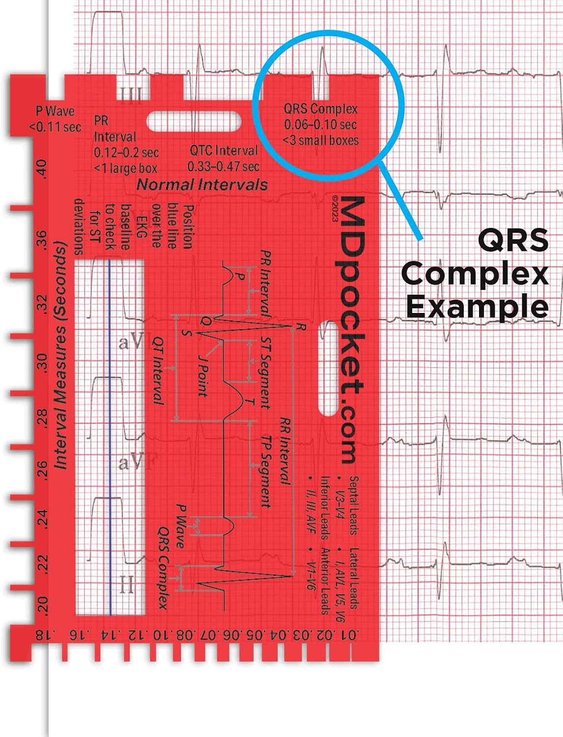 Rapid ID - EKG Intervals and Infarctions with Clear Window