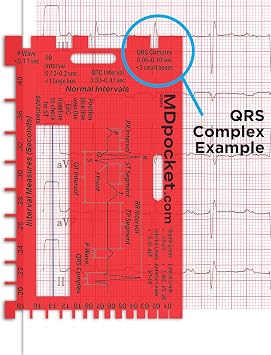 Rapid ID - EKG Intervals and Infarctions with Clear Window