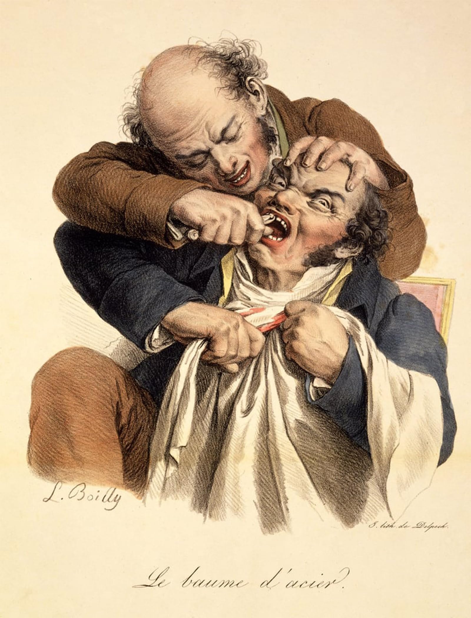 SERENDIPITP Retro Picture Poster Wall Art Pictures Painting Having a Tooth Pulled Pub by Louis Leopold Boilly Wall Art Canvas Print for Wall Decor 60x90cm