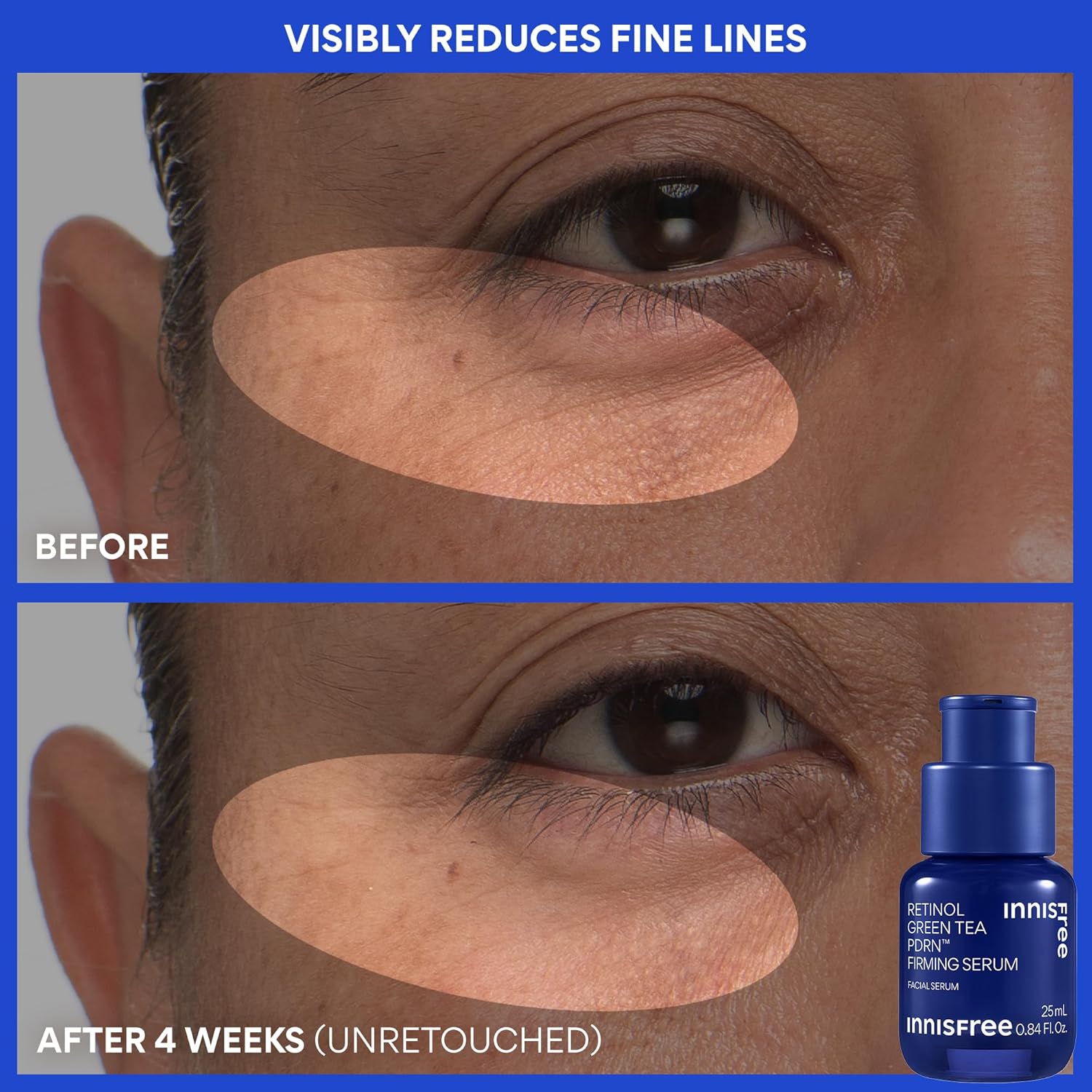 innisfree Green Tea Retinol PDRN Firming Serum - Vegan Korean Skincare for Fine Lines and Smoothing Skin Texture, Available in Gift Set - Image 4