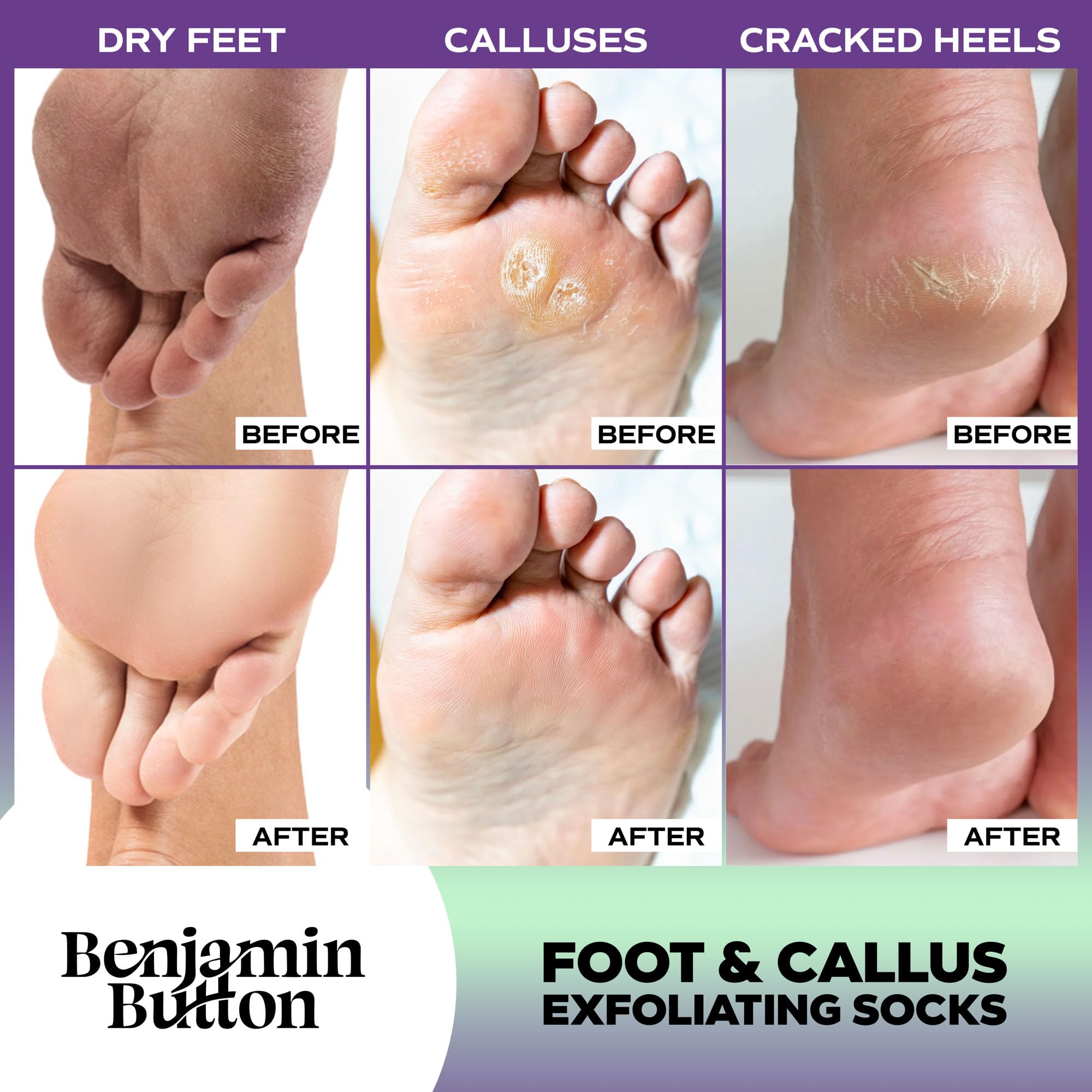 Benjamin Button Luxury Foot Peel Mask - 5x works, 1 count (Pack of 5) - Image 4