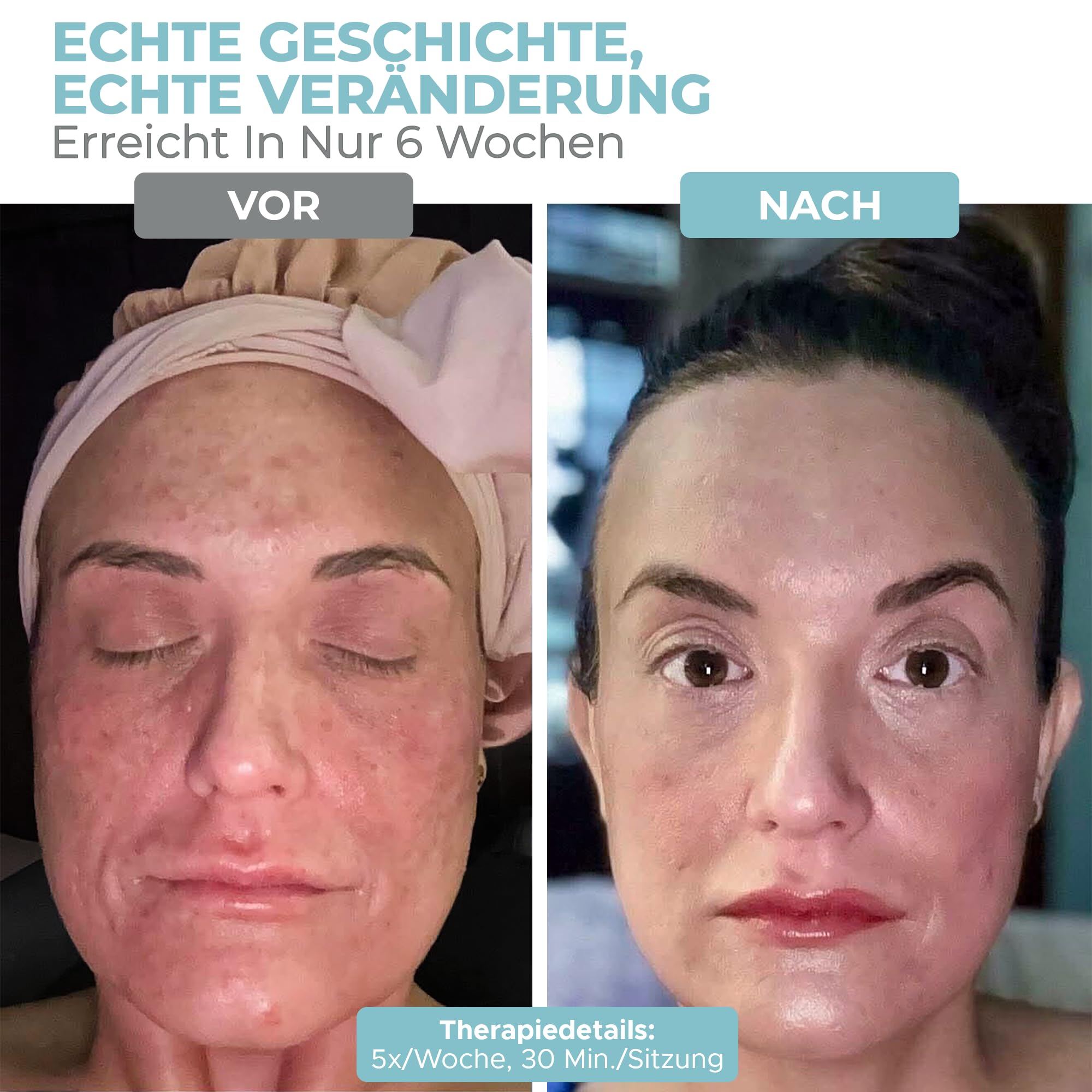 Nourished Bodynskin 7 Farben LED-Gesichts- und Nackenmaske mit Nahinfrarot - Blaues, rotes Lichttherapiegerät für das Gesicht - 912 LEDs - Hautpflege-Werkzeug gegen die Hautalterung