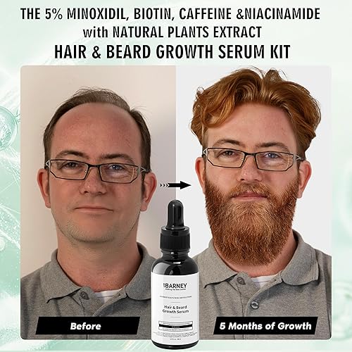 Miniatura 3 de Suero para el crecimiento del cabello y la barba de minoxidil al 5 %, extractos naturales, biotina y cafeína, promueve un crecimiento más fuerte,