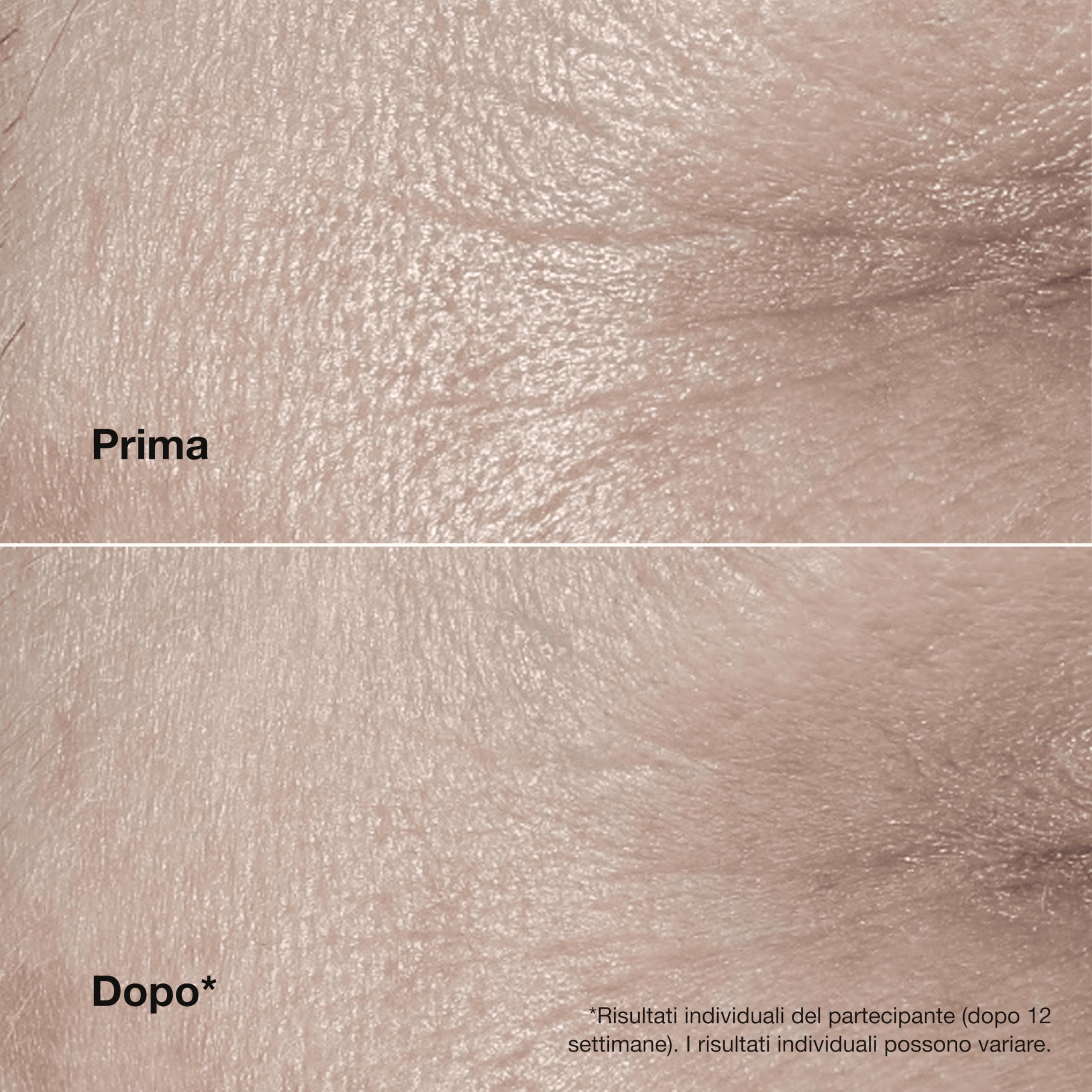Clinique Smart Clinical Repair Wrinkle Correcting Rich | Crema Viso Idratante anti-Età, 50 ml