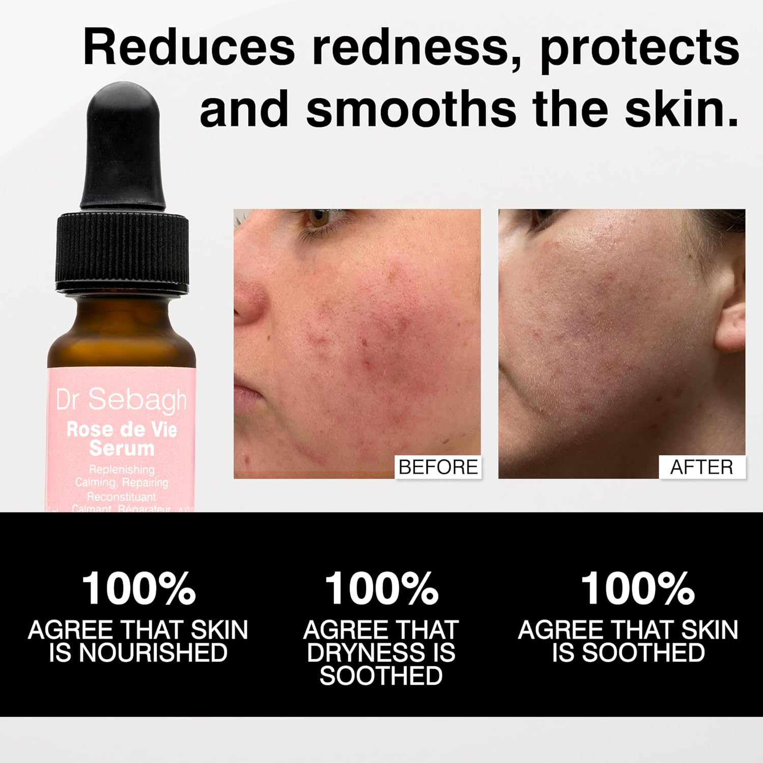 Dr Sebagh Rose de Vie Serum - 0.17 fl oz - Award-Winning Nourishing Anti-Aging Formula - Use with Dry, Mature, or Sensitive Skin - Designed to Soothe Redness & Irritation - Regenerating & Invigorating - Image 6