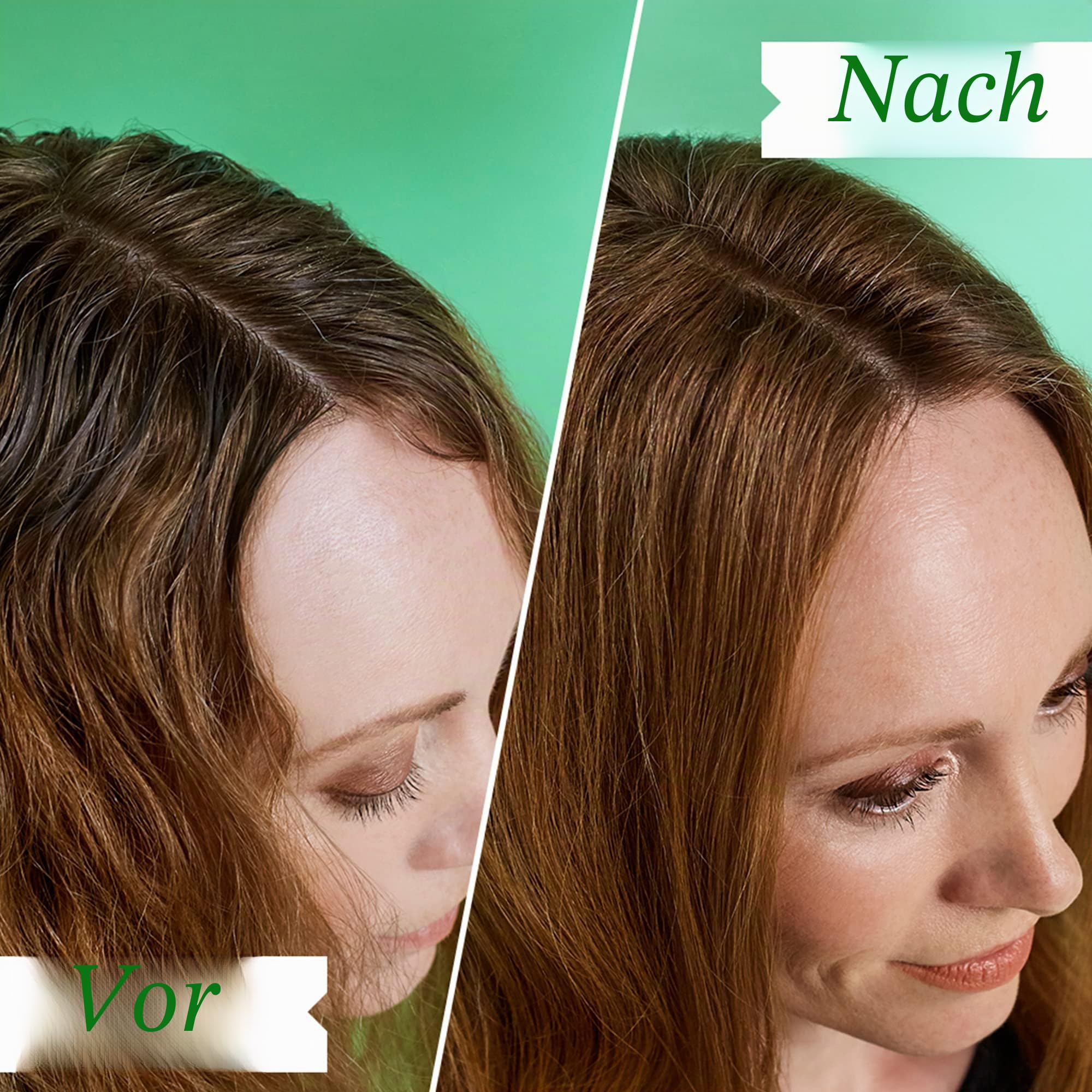 Philip Kingsley | Schuppiges/juckendes Kopfhautshampoo | Anit-Dandruff Shampoo für schuppige, juckende, trockene, fettige Kopfhaut | Reinigung der Kopfhaut | 1000ml