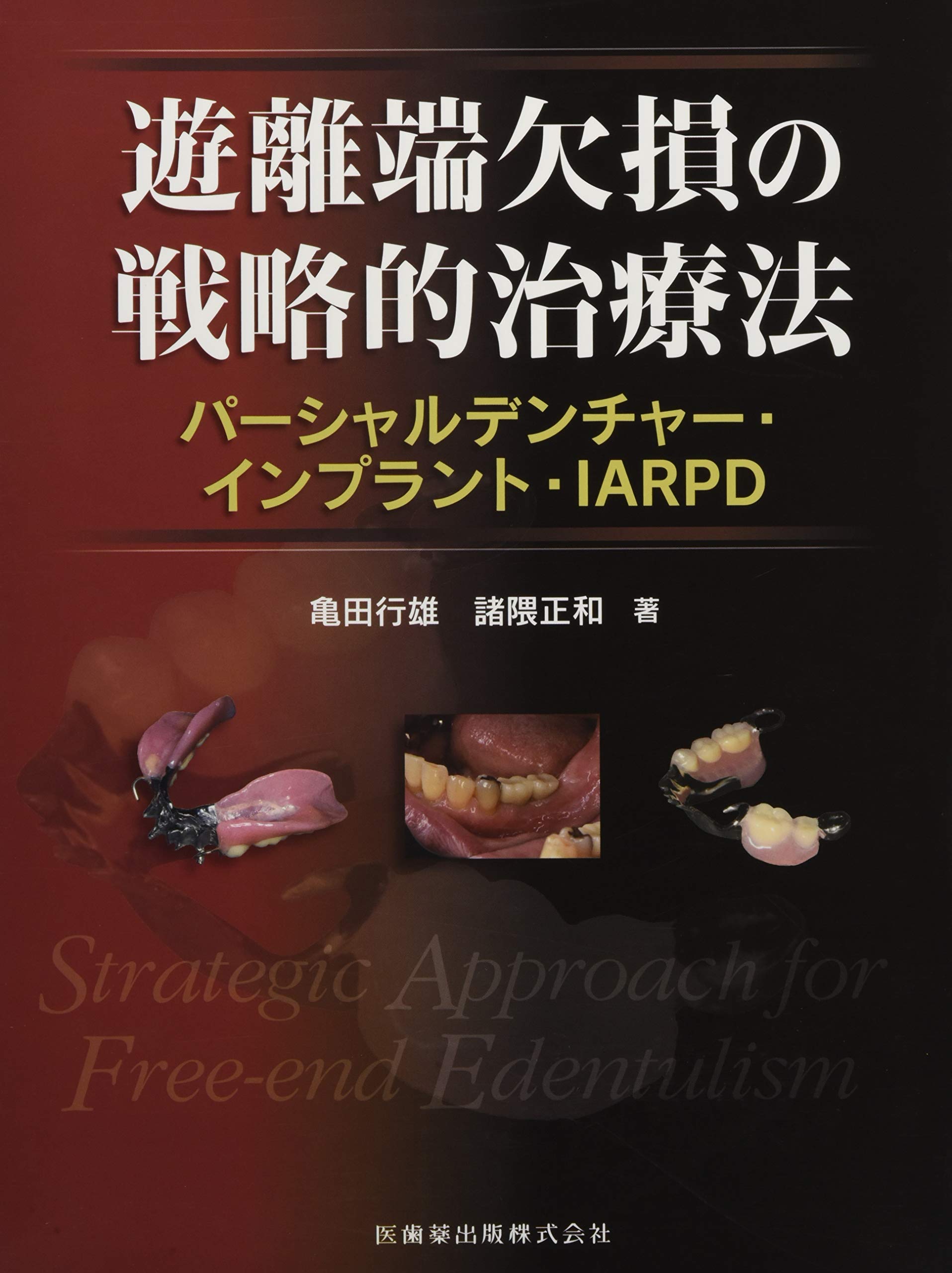 遊離端欠損の戦略的治療法 パーシャルデンチャー・インプラント・IARPD