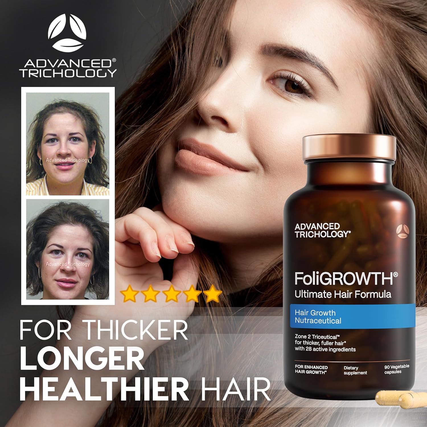 FoliGROWTH® Hair Growth Supplement for Women & Men | For Thicker, Fuller Hair | American Hair Loss Association Approved | Supports Thinning Hair - Image 3