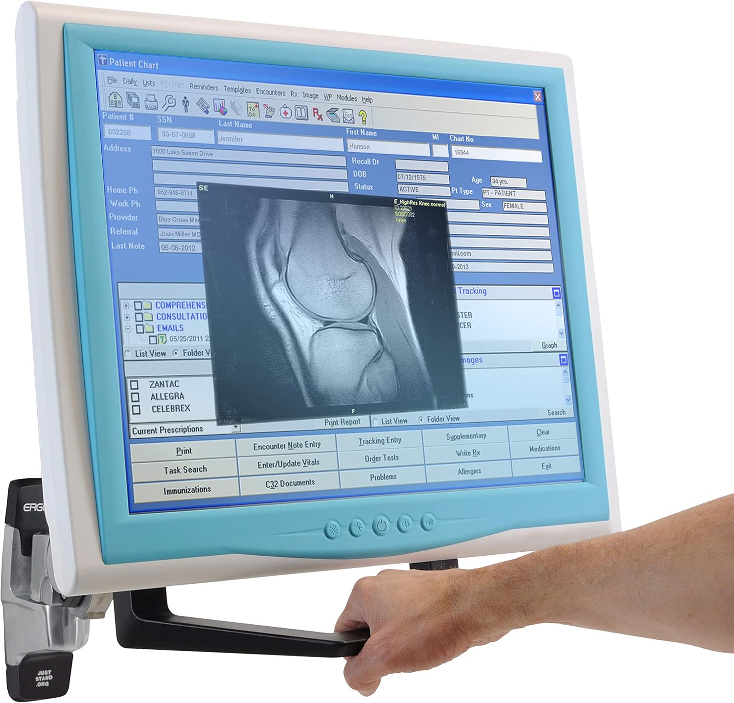 Ergotron – Monitor Handle Kit – for Monitors Up to 32 Inches – Add-on for VESA Monitor Arms