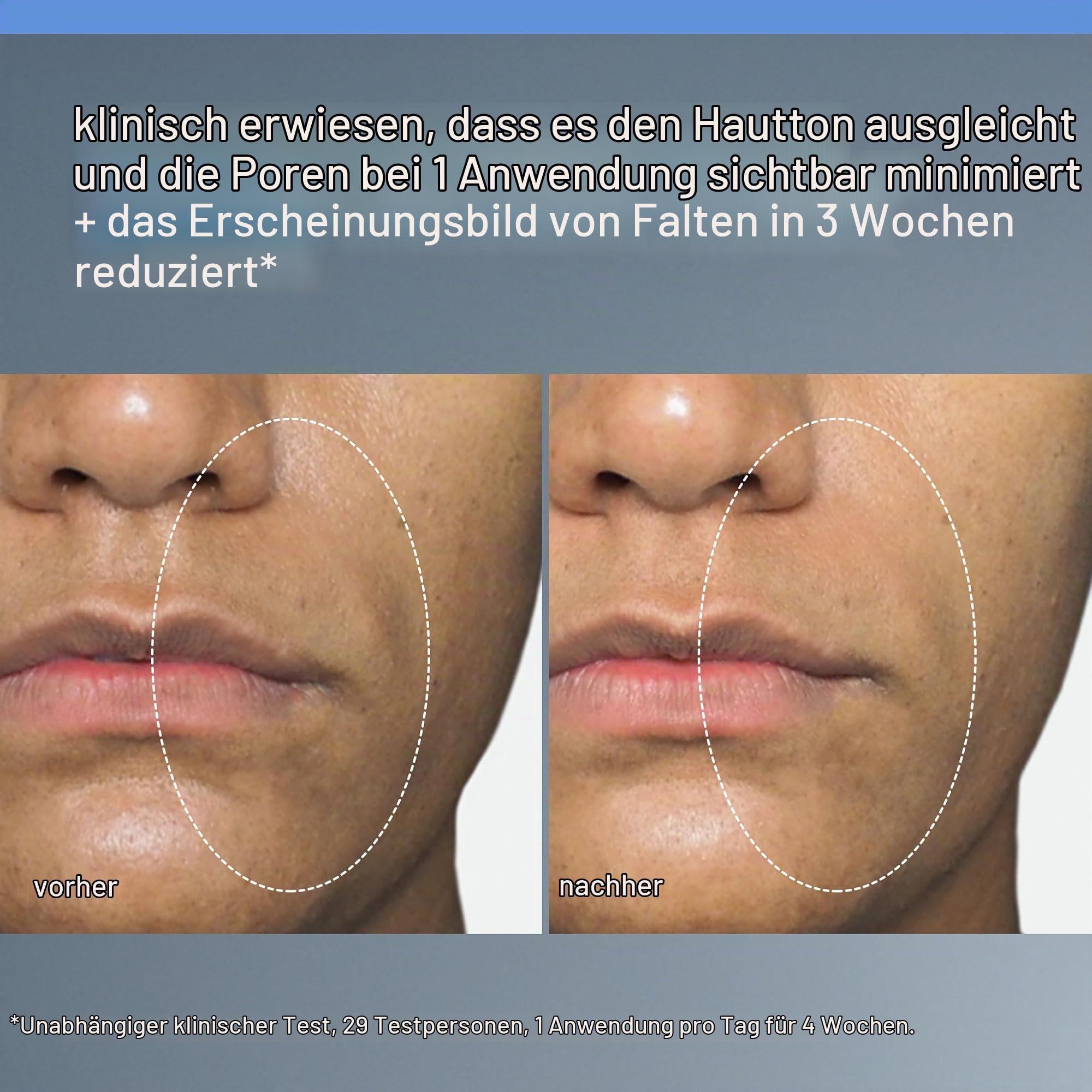 Dermalogica Liquid Peelfoliant tägliches Gesichtspeeling 59ml | Tägliches Flüssigpeeling mit Säuren und Enzymen, das Poren klärt und die Hautstruktur glättet.