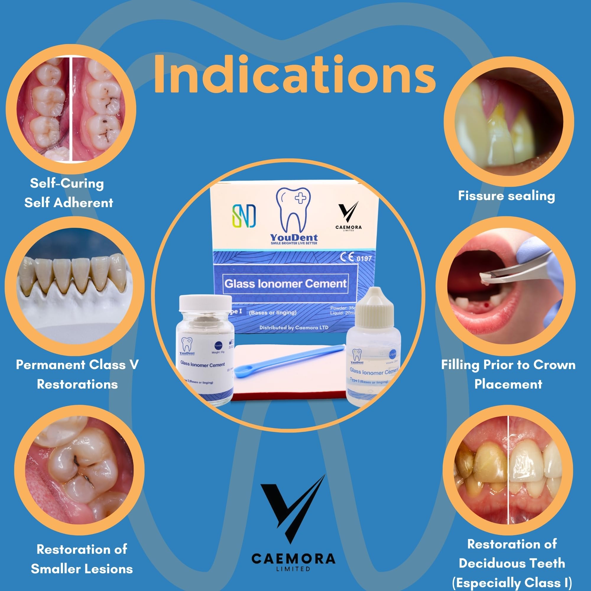 Caemora Kit de reparación dental Cemento dental de ionómero de vidrio Relleno permanente