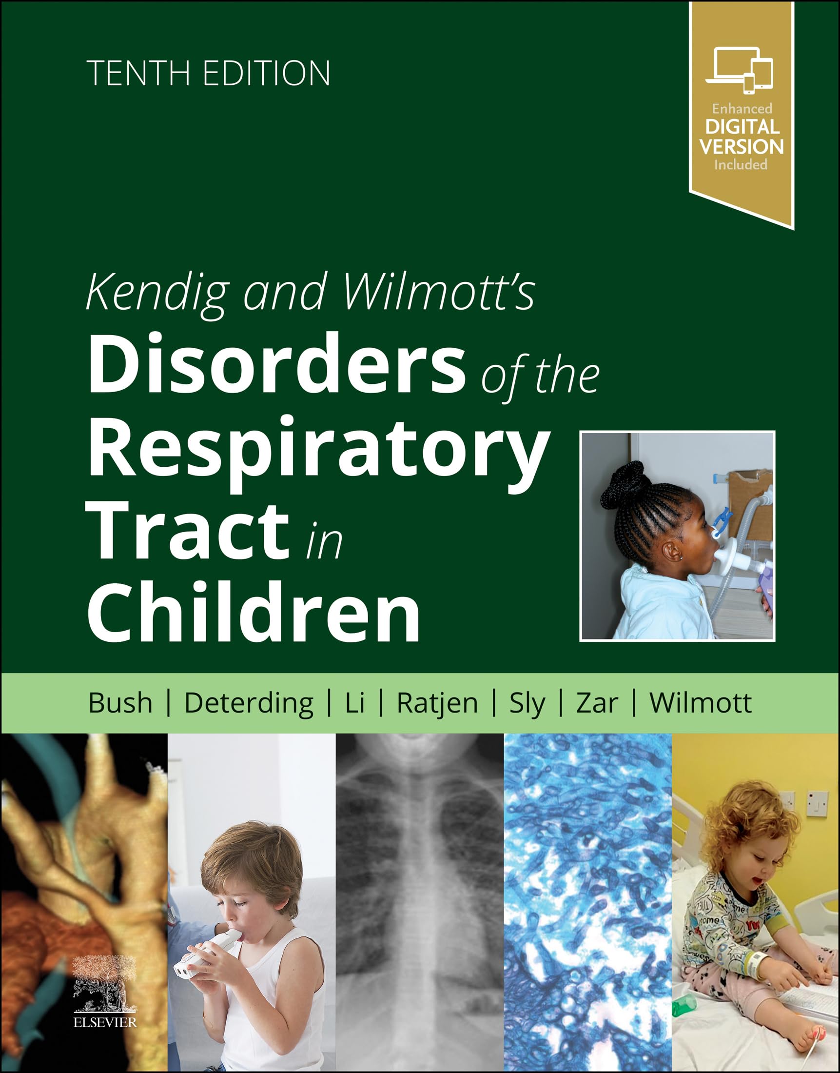 Kendig and Wilmott's Disorders of the Respiratory Tract in Children - E-Book