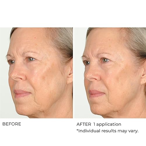 Miniatura 5 de NassifMD Hydro-Screen Suero facial de ácido hialurónico hidratante de ceramida suero de retinol ácido hialurónico hidratante suero de ceramida