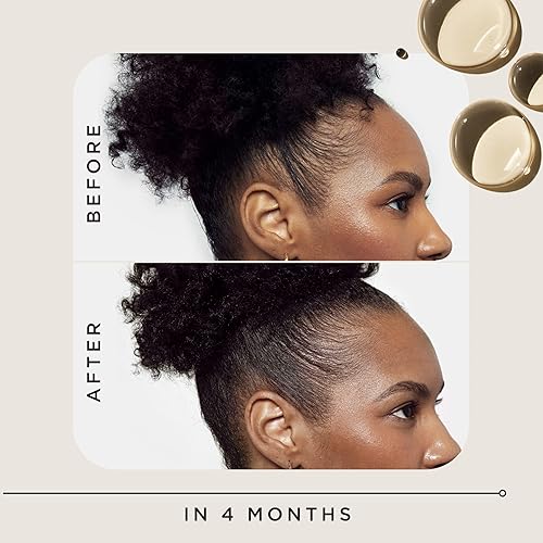 Miniatura 5 de Carol's Daughter Goddess Strength - Tratamiento de crecimiento del cabello para mujeres, solución de minoxidil al 2% para pérdida y adelgazamiento