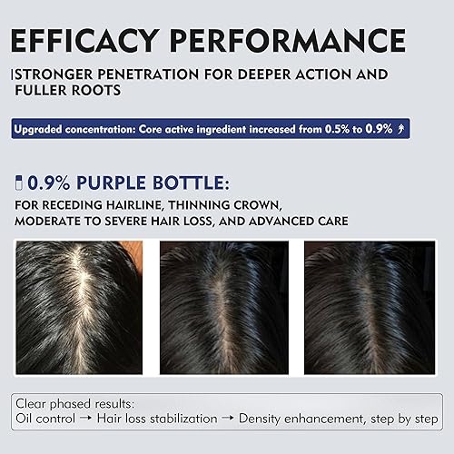 Miniatura 4 de KINTOR 0.9% KX-826 DHT bloqueador para hombres y mujeres crecimiento del cabello, productos de crecimiento del cabello Spray 2.0 fl oz Pro