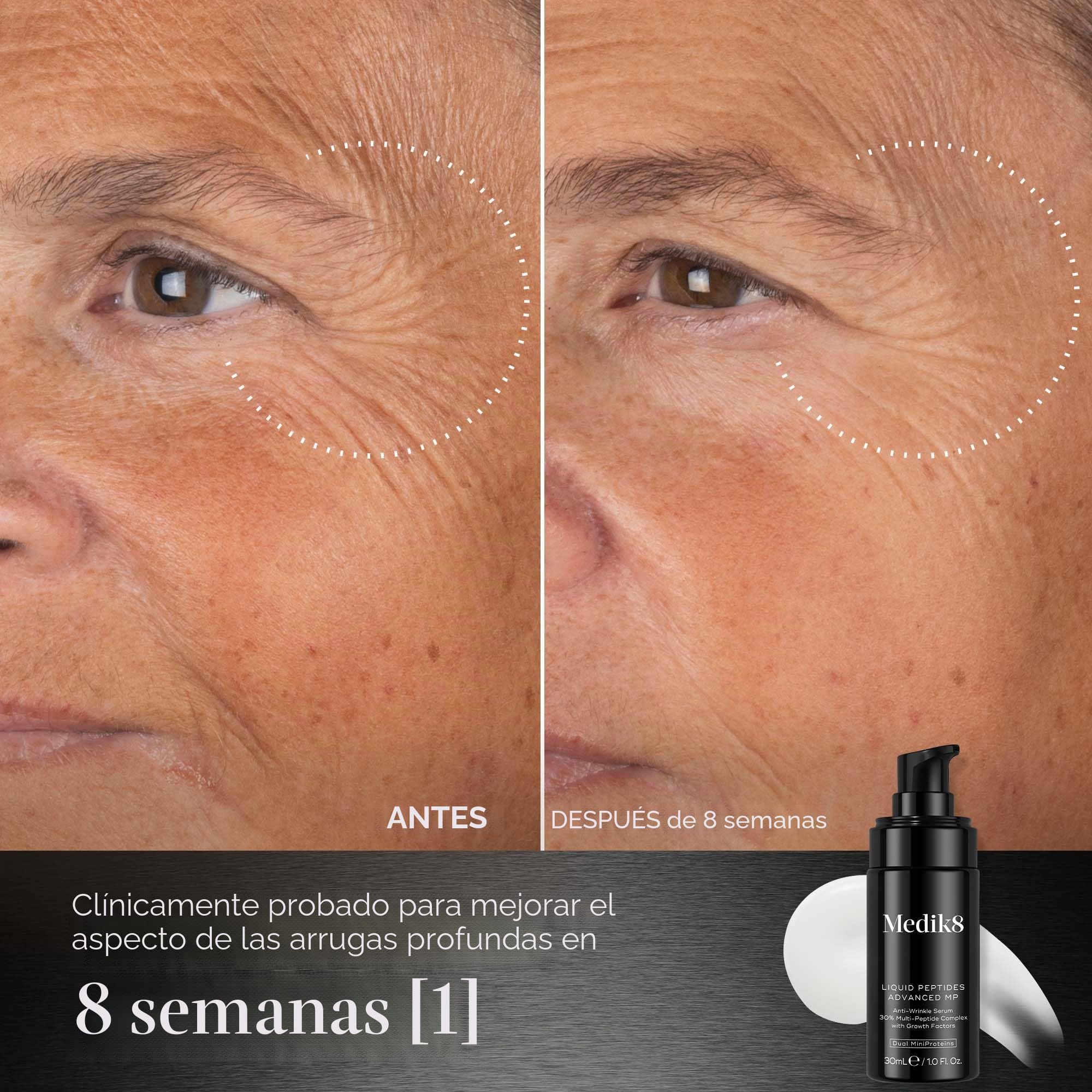 Medik8 Liquid Peptides Advanced MP – Con tecnología biotecnológica innovadora, Dual MiniProteins – 30% de complejo multipéptido – 30 ml