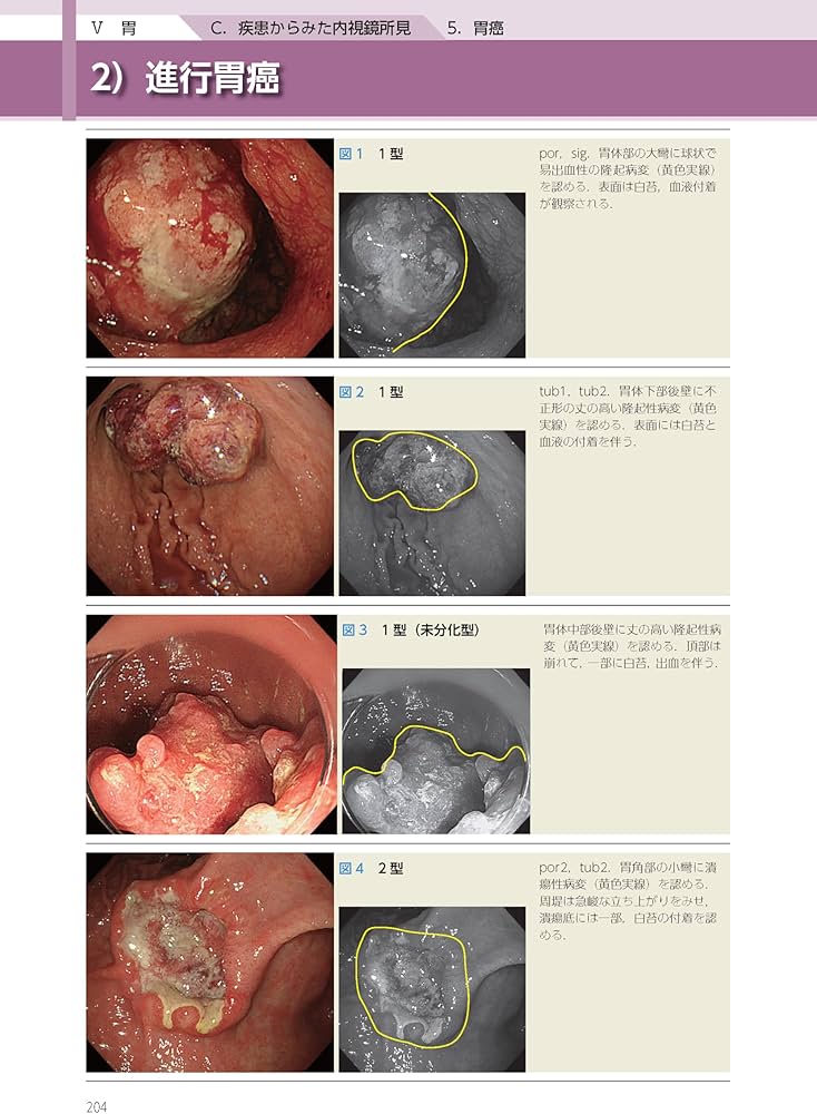 消化管内視鏡診断テキスト I 食道・胃・十二指腸 第5版 (消化器画像