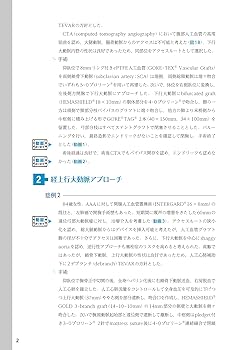 Amazon.co.jp: ステントグラフト内挿術マニュアル 胸部編