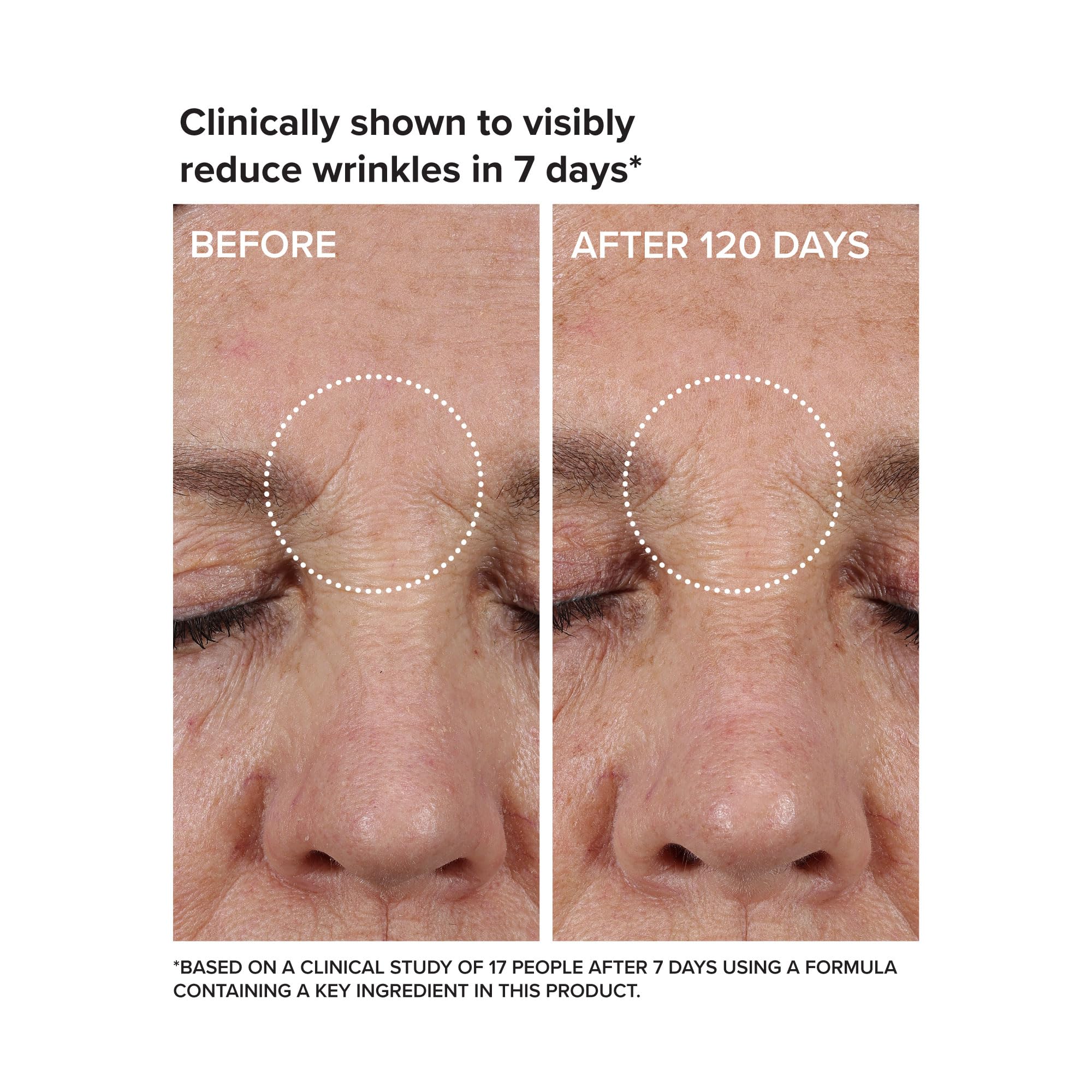 DRMTLGY Needle-less Growth Factor Serum for Face – Multi-Peptide & Hyaluronic Acid Facial Serum, Firming & Lifting, Skin Barrier Support & Wrinkle Care