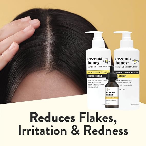 ECZEMA HONEY Scalp Kit - Natural Anti Dandruff Shampoo, Conditioner, Scalp Oil for Flakes - Argan Oil & Tea Tree Oil for Hair - Eczema Treatment Helps Psoriasis, Seborrheic Dermatitis, More