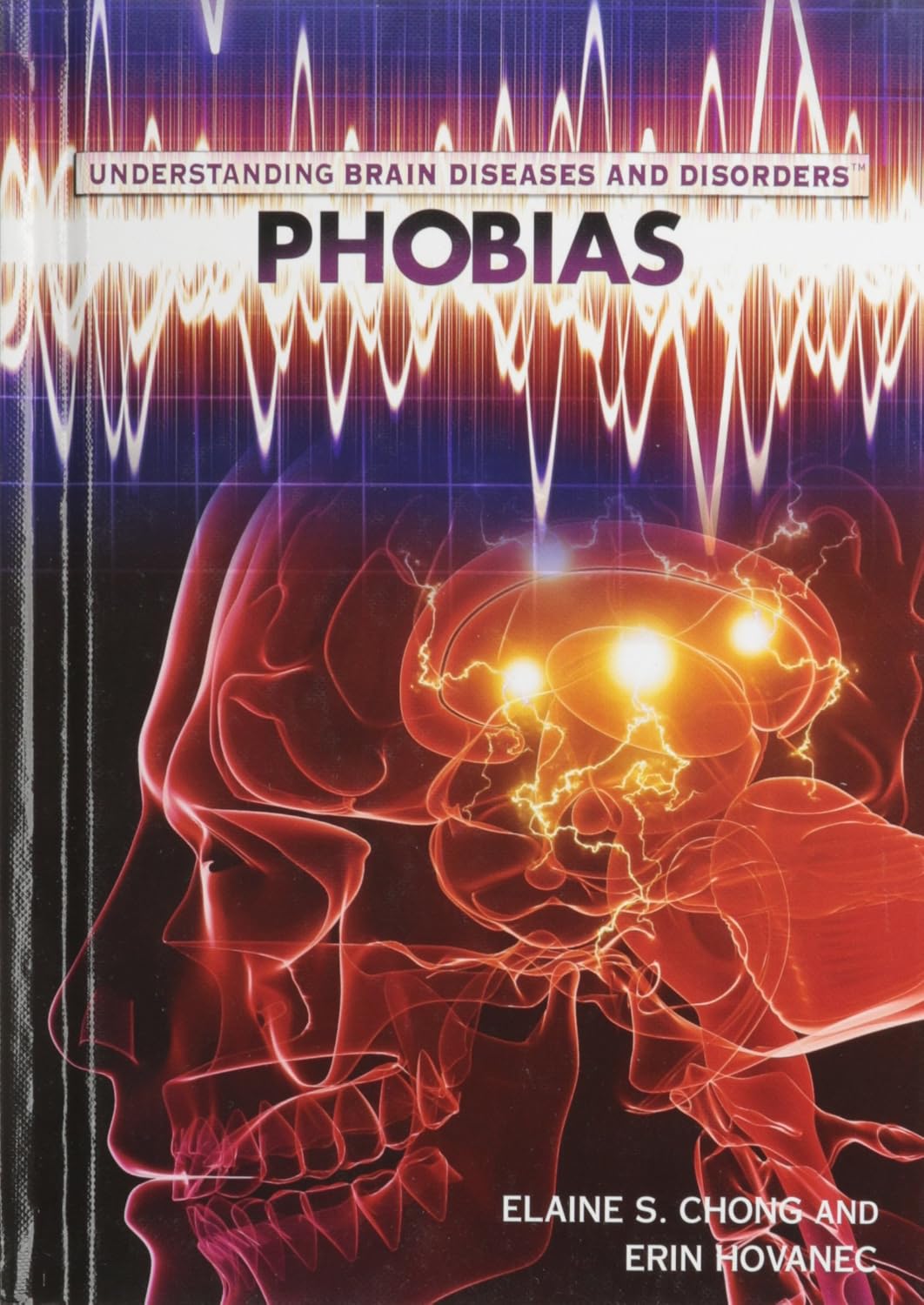 Phobias (Understanding Brain Diseases and Disorders)      Library Binding – Illustrated, December 30, 2011