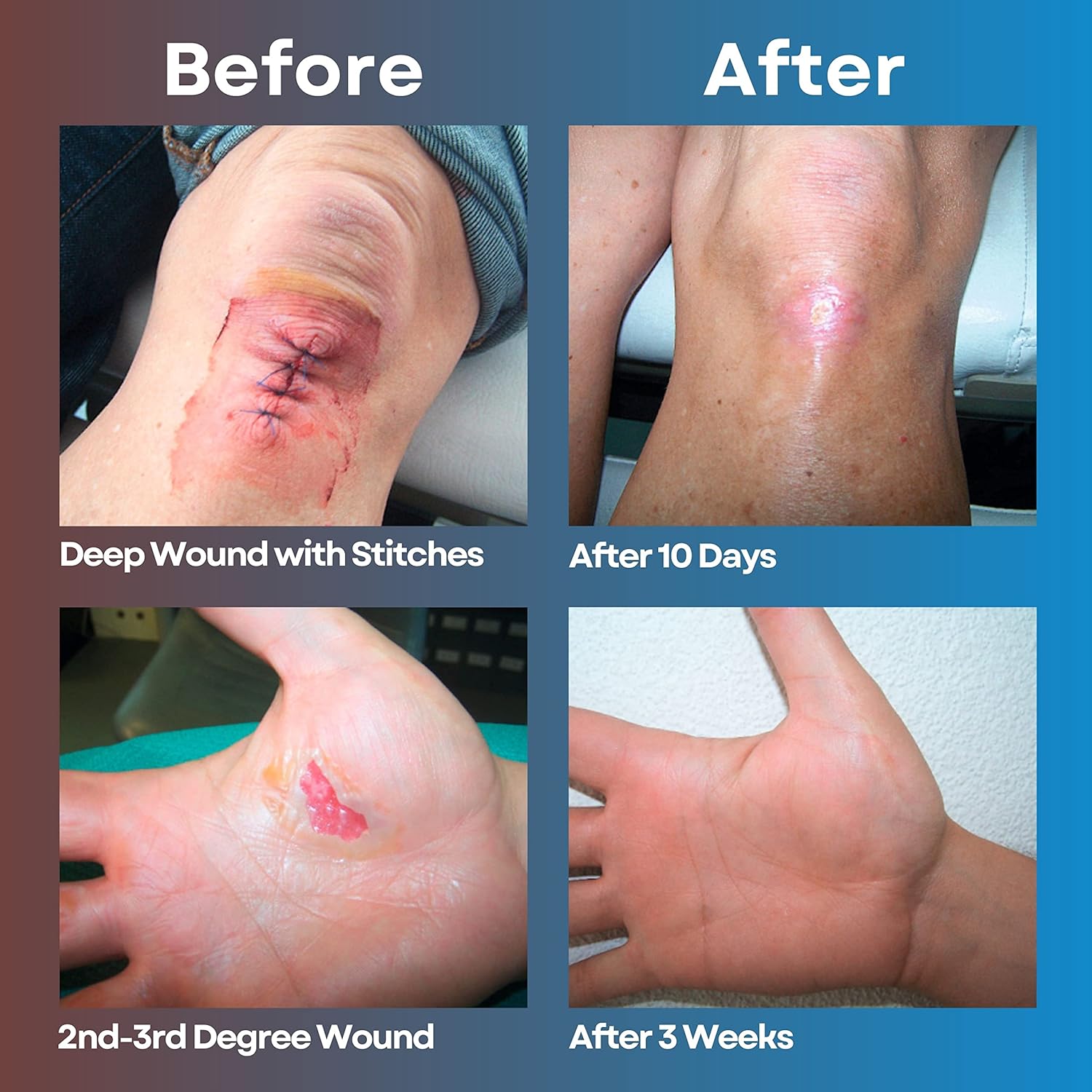 MEDIQUICK Skin and Wound Treatment Bundle | First Aid Healing Mist and Hydrogel Drops | Cool and Soothe Minor Cuts and Burns, Scrapes, Abrasions, Itch, Bites, Inflammation (Duo Care Pack)