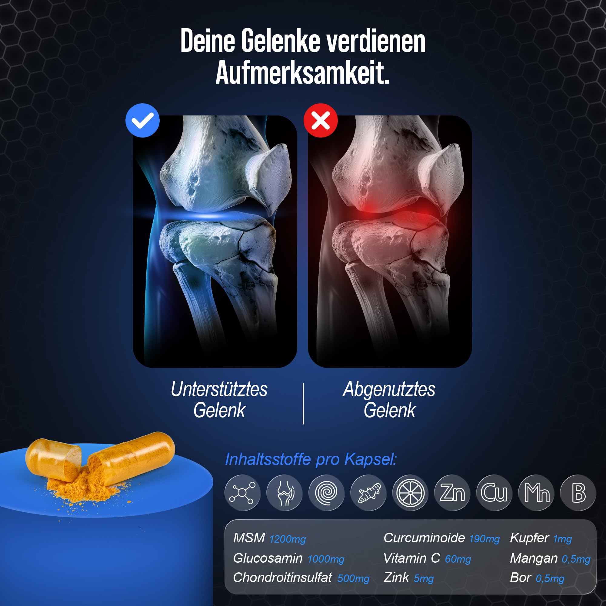 Arthrose-Komplex - Gelenkkapseln, Hochdosiert für Gelenke-, Knie- und Knorpelschutz | Made in Germany, Unterstützung bei Arthrose & Gelenkschmerzen | Knorpelaufbau-Support, 120 Kapseln