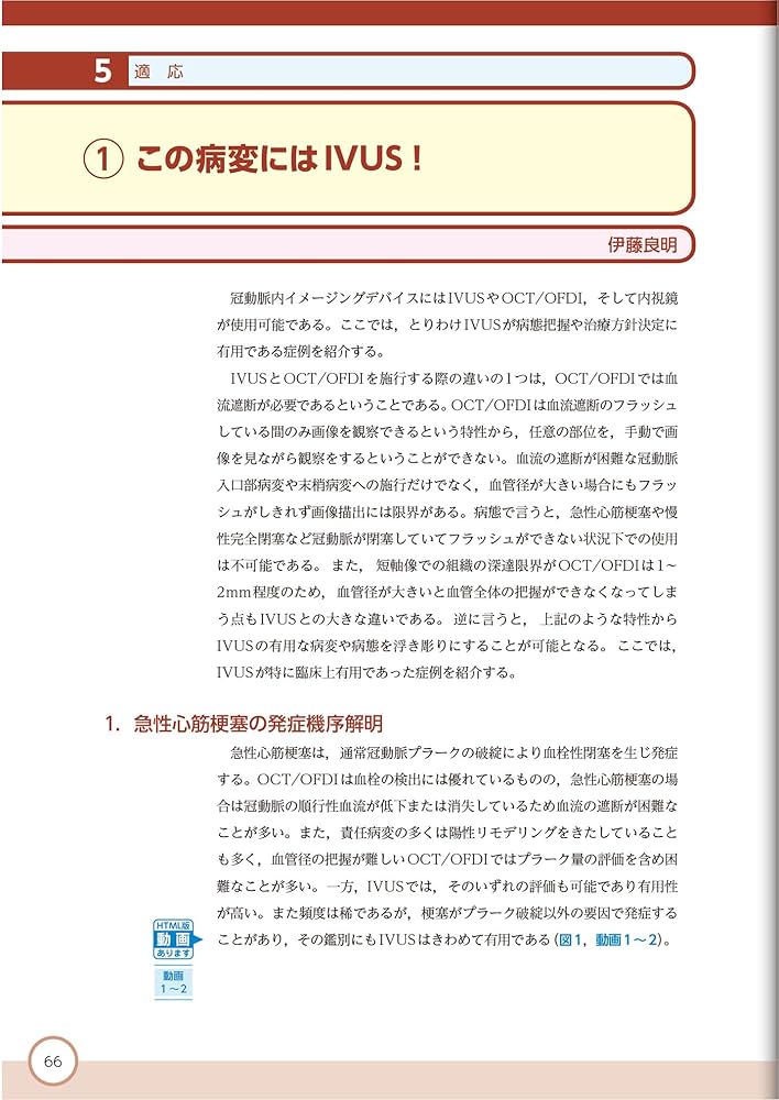 血管内イメージングパーフェクトガイド 【動画を含む電子版付