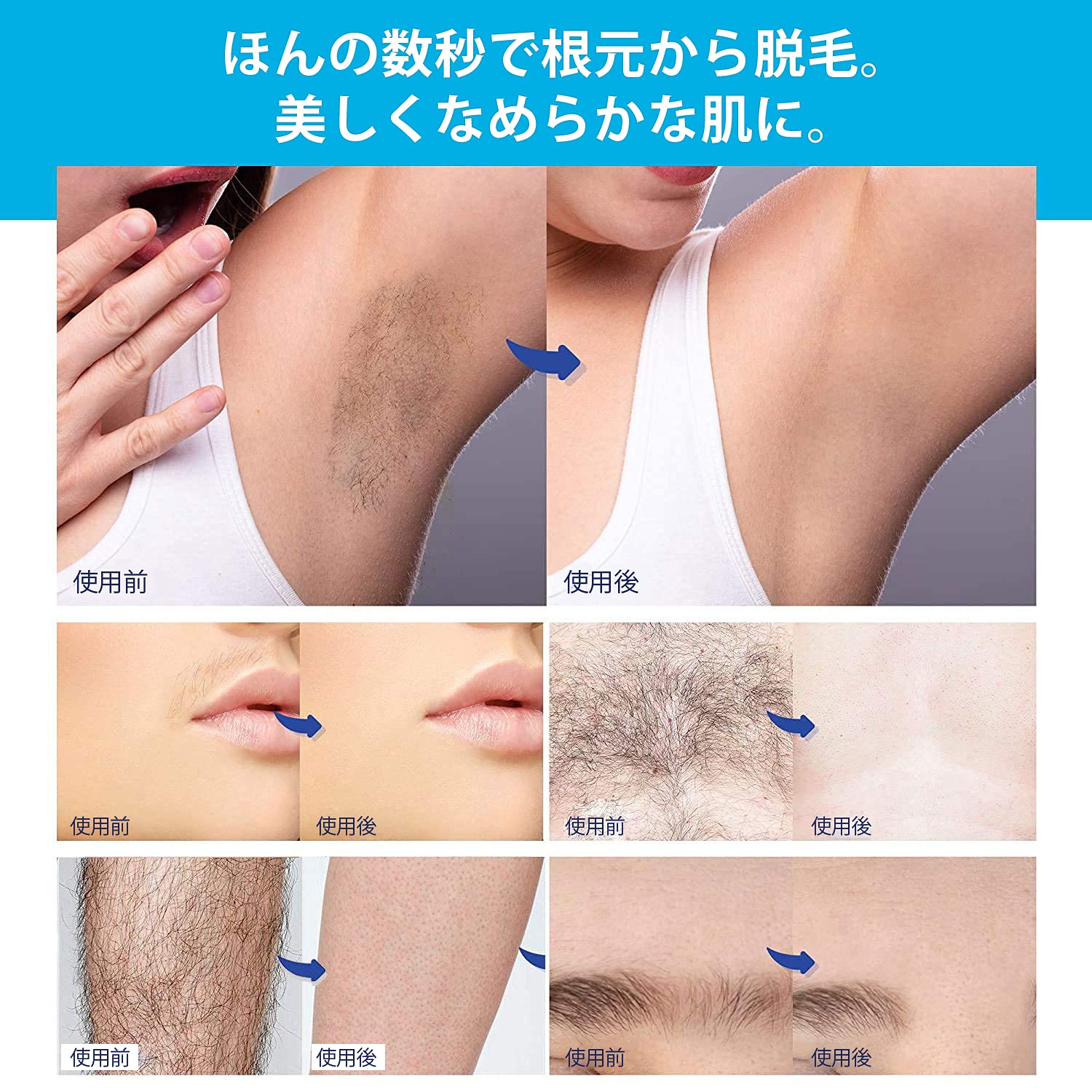 Amazon.co.jp: 脱毛シート 脱毛ワックス 脱毛 ブラジリアンワックス