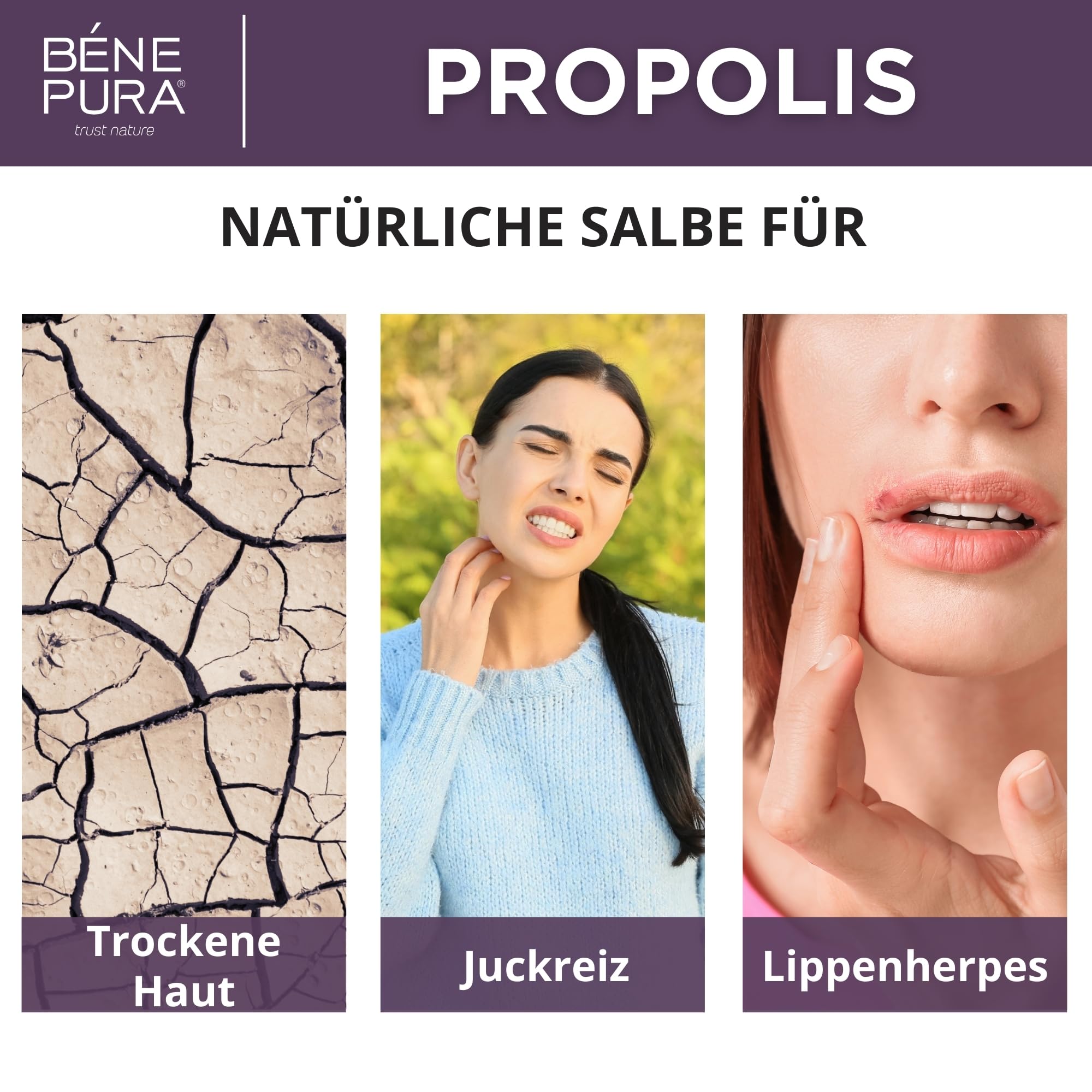 BenePura Propolis Salbe, Natürliche 30% Propolis Salbe für Juckende, Trockene und Rissige Haut, 40 ml (3er Pack)