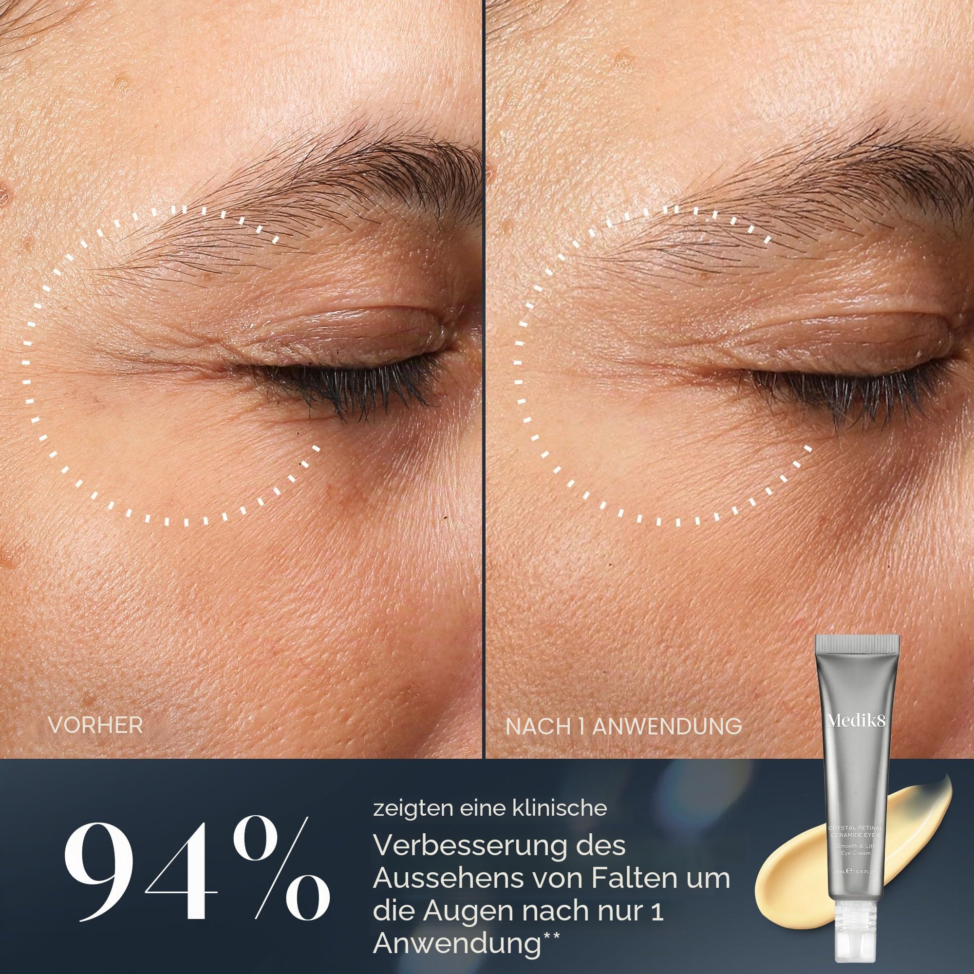 Medik8 Crystal Retinal Ceramide 10 Augencreme - Anti-Aging & Anti-Falten- Glättungs- & Straffungs-Augencreme - 0.10% Retinalstärke - 11-mal schneller als Retinol - 15ml