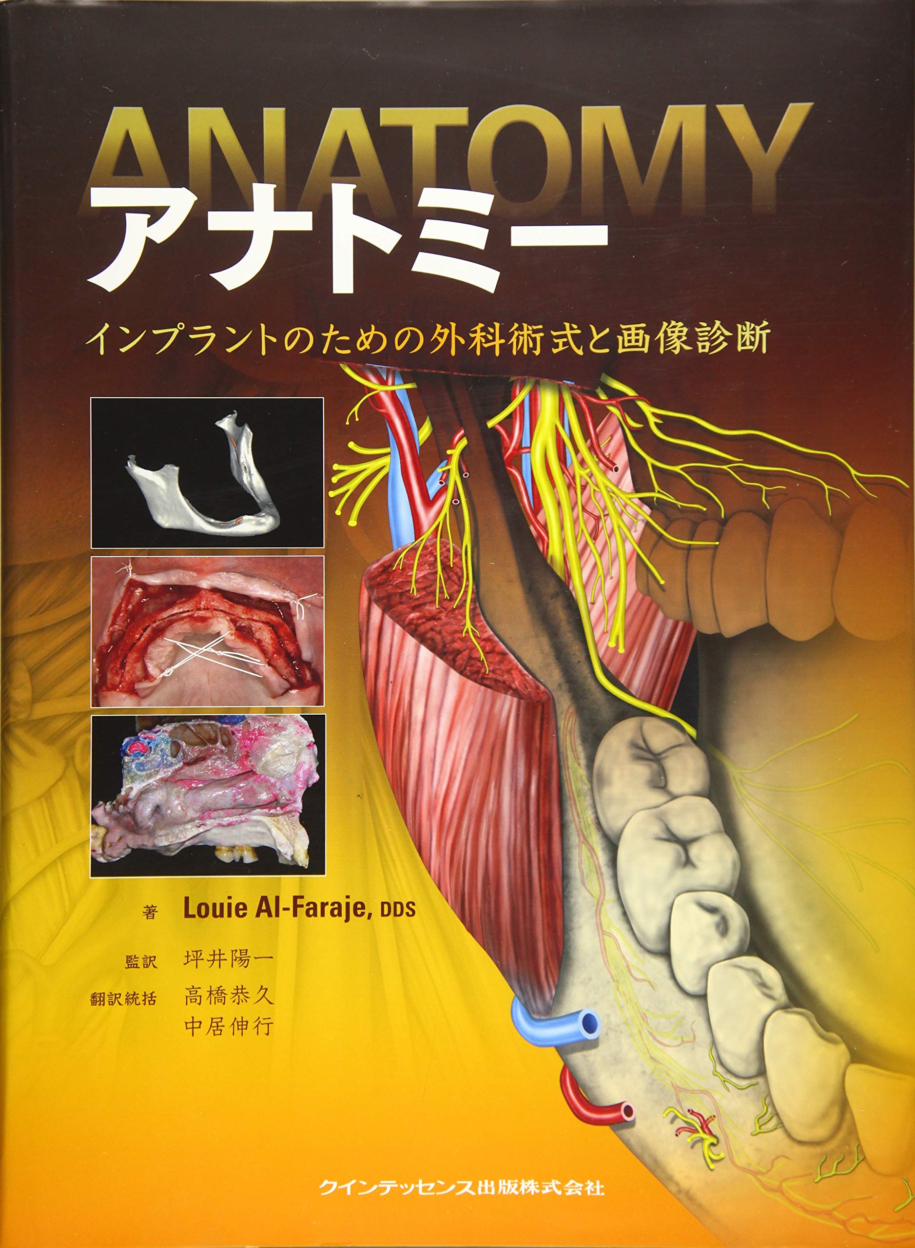 アナトミー | Louie Al-Faraje, 坪井 陽一, 高橋 恭久, 中居