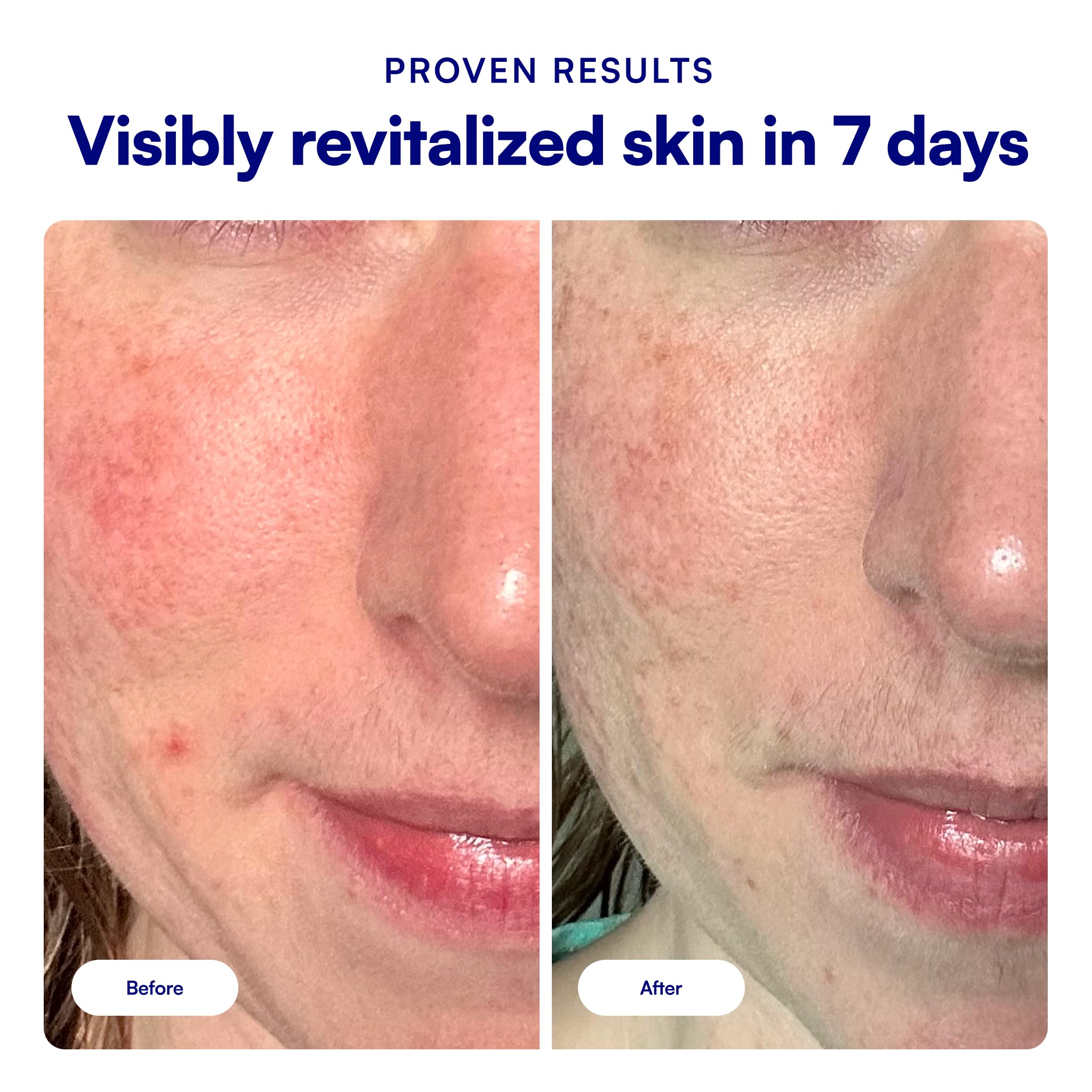 Bliss Incredi-Peel Facial Peel Pads - Glow Up! -4 Bliss Incredi-Peel Facial Peel Pads - Glow Up! -4