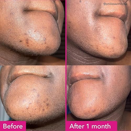 Miniatura 3 de Good Molecules Barra Iluminadora y de Manchas Oscuras – Barra Facial y Corporal Sin Jabón – Ácido Tranexámico, Ácidos Kójicos y Niacinamida para