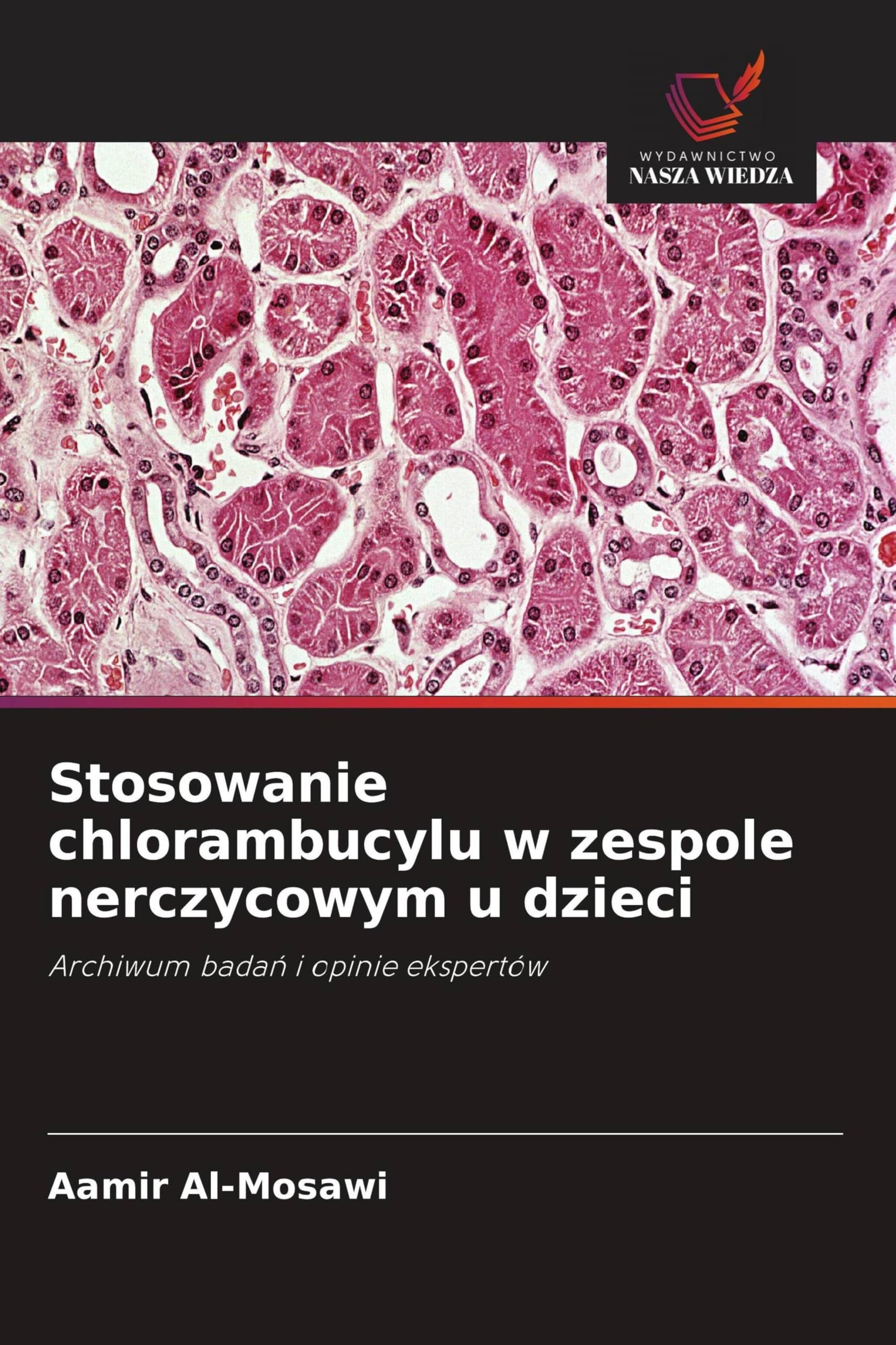 Stosowanie chlorambucylu w zespole nerczycowym u dzieci: Archiwum bada¿ i opinie ekspertów