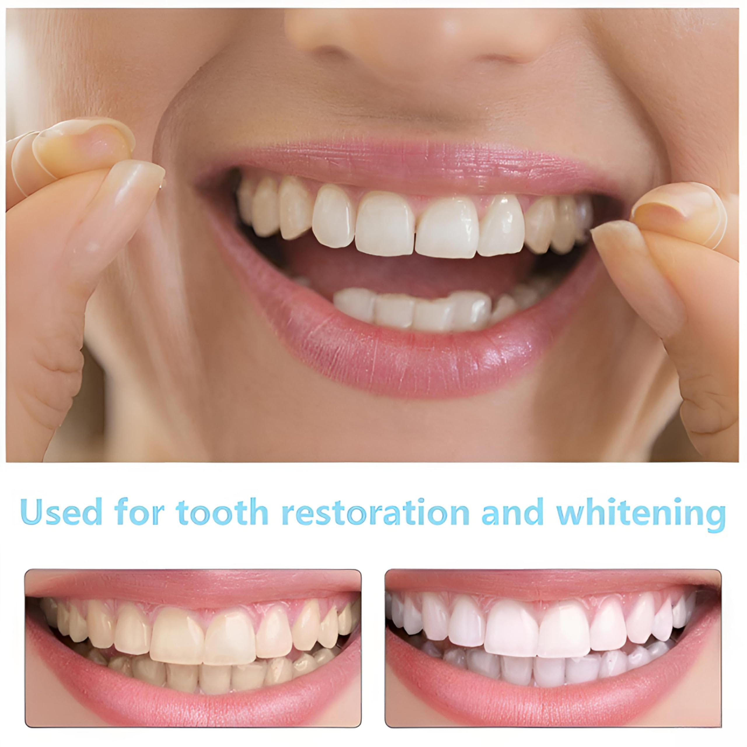 2 Pairs of Unisex Smile Supports,Natural Comfort, Adjustable Comfort (Unisex) Create A Beautiful and Confident Smile — view 6