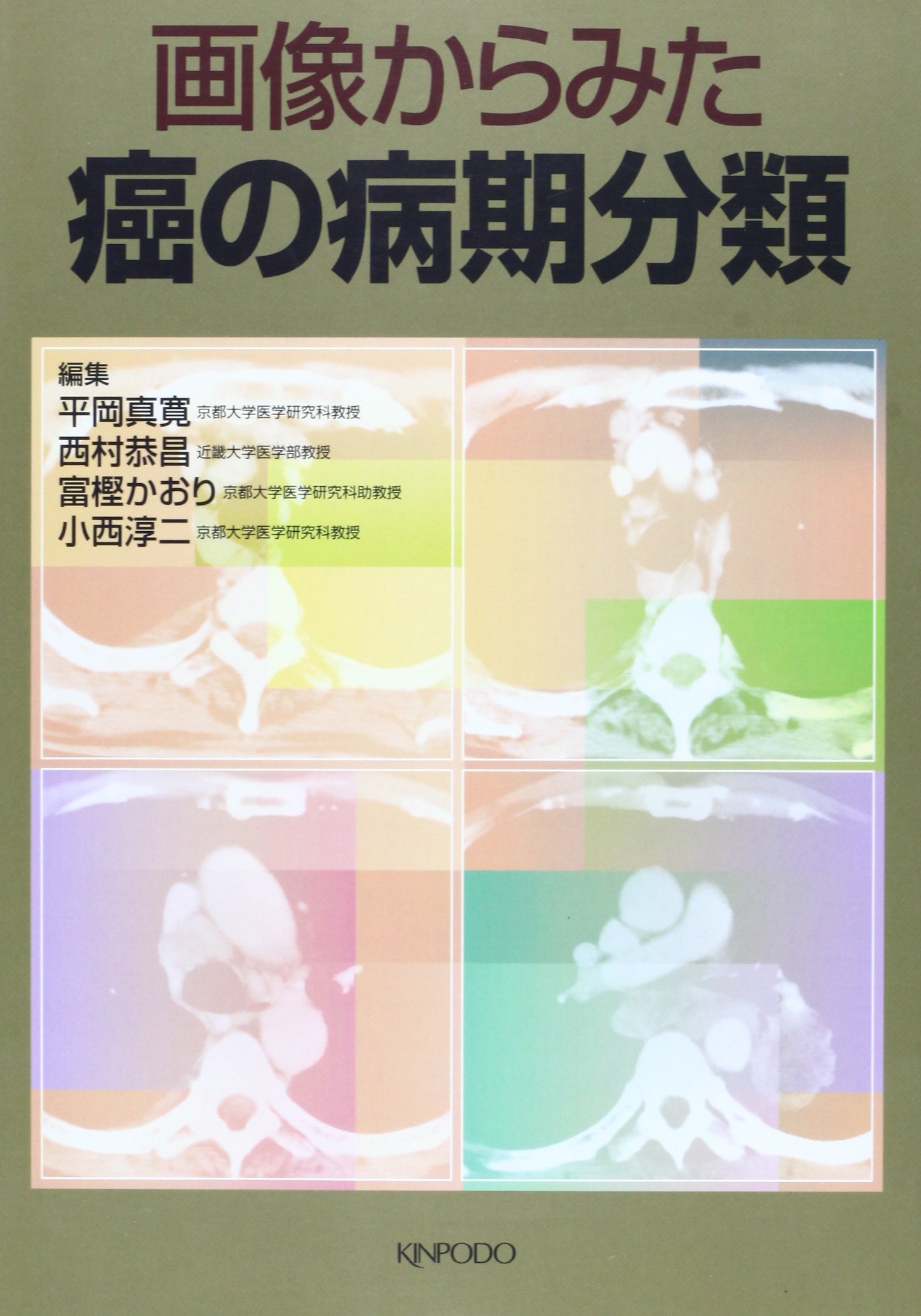 画像からみた癌の病期分類 | 平岡 真寛 |本 | 通販 | Amazon