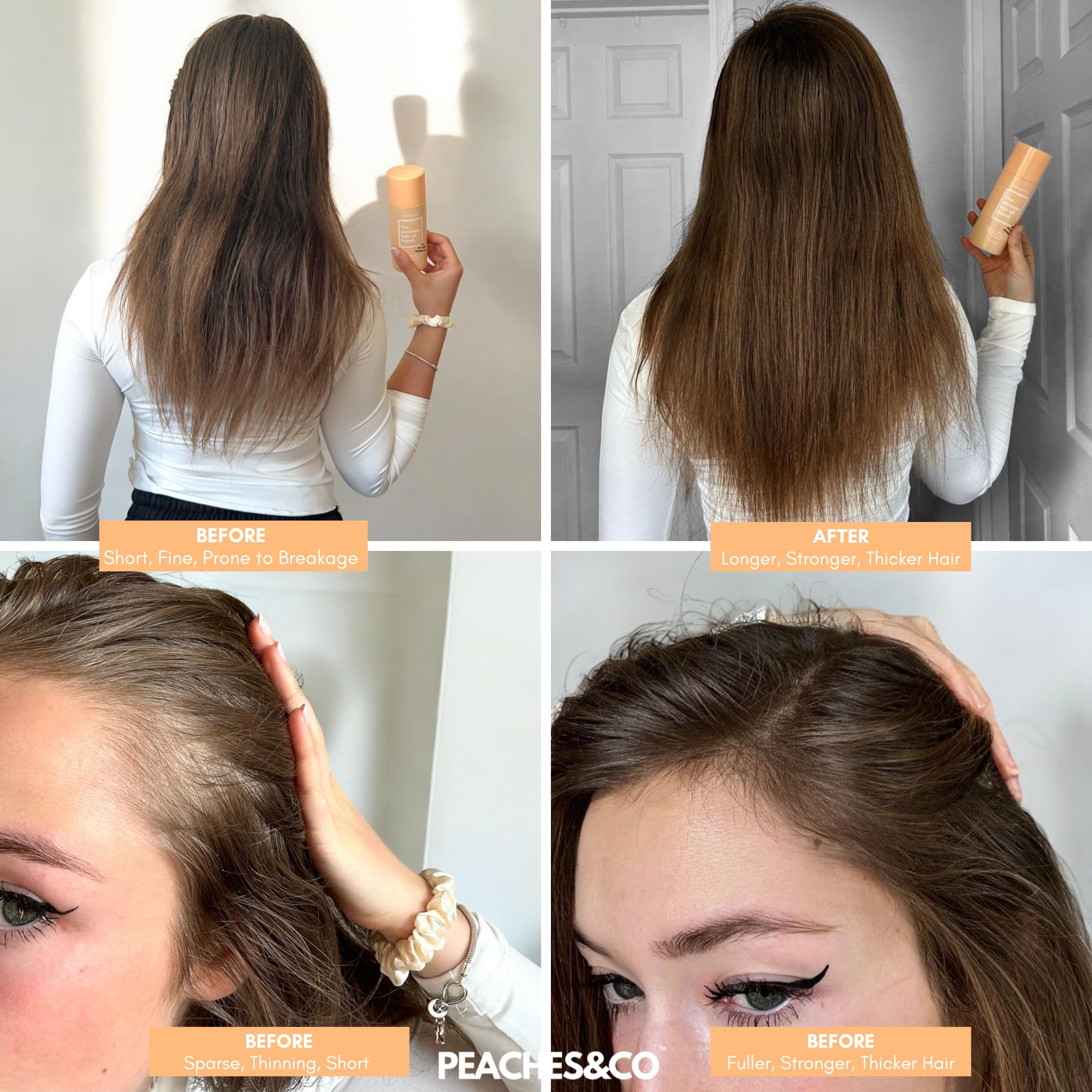 Hair Growth Oil - Rosemary & Avocado Blend with Castor, Jojoba, Camellia & Vitamin E, Peach, 150 ml (Pack of 1) - Image 3