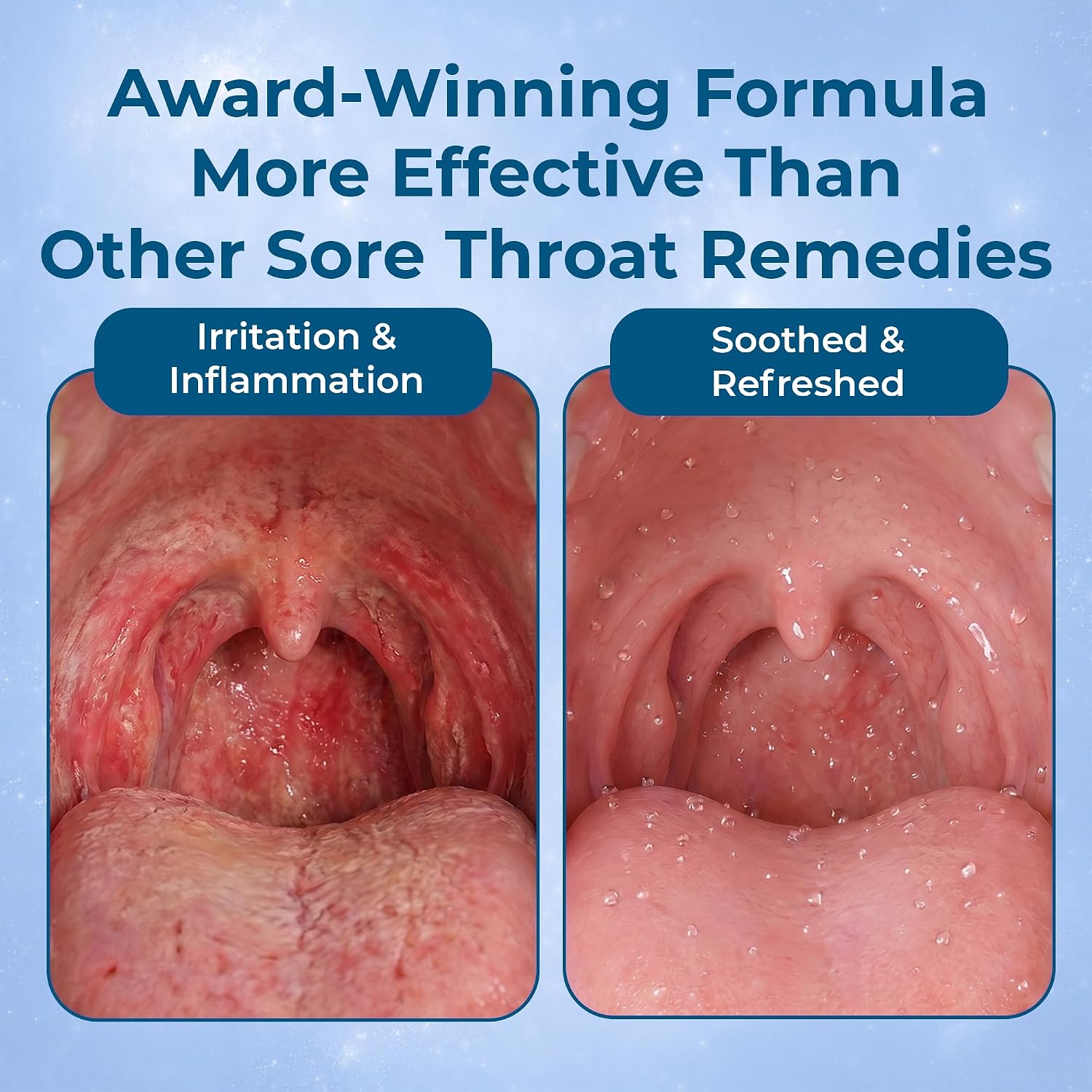 ioRinse STR (Sore Throat Relief) Professional Strength Gargle. Instantly soothes inflamed throats. ioRinse is recommended by thousands of healthcare professionals because it simply works better. 16 oz image 3