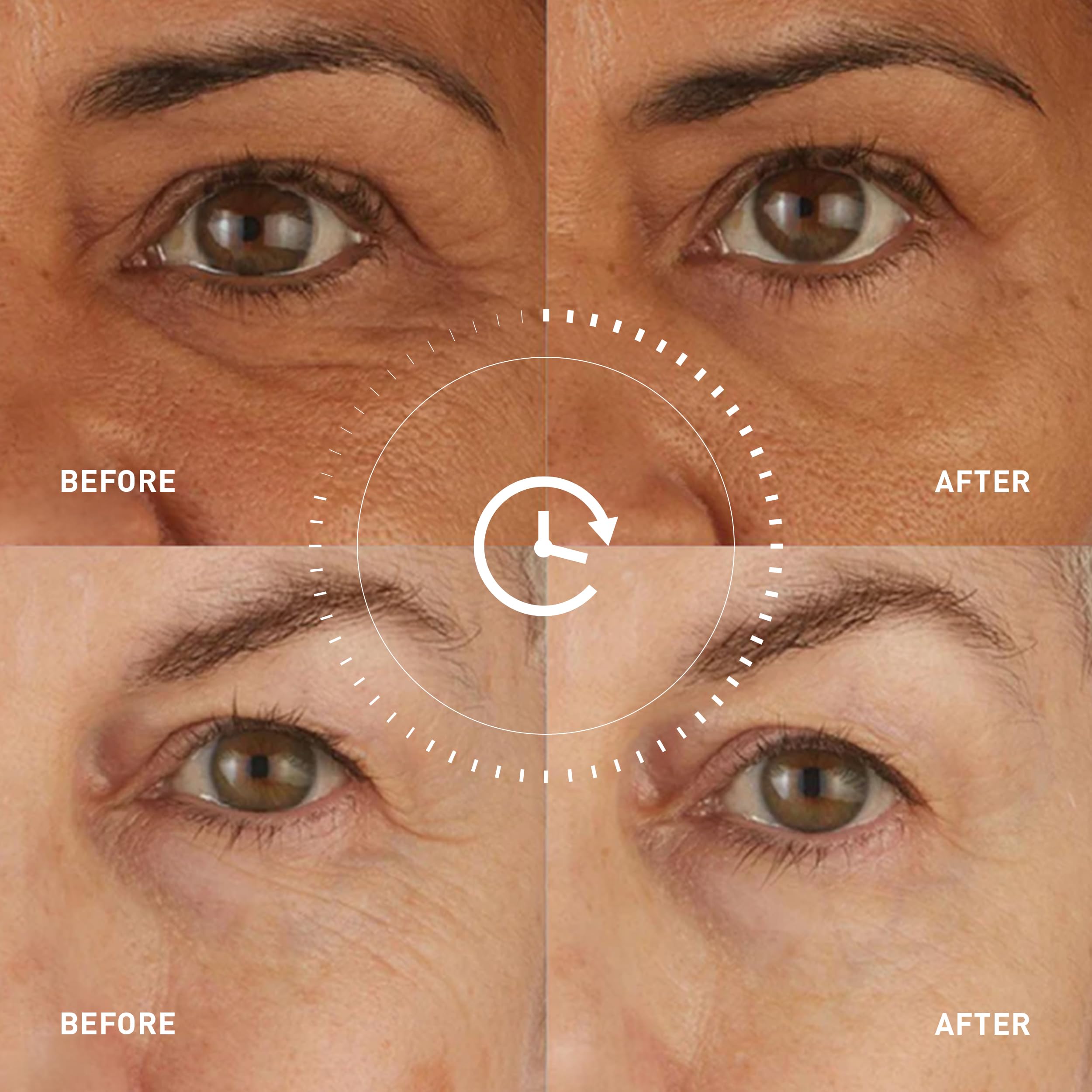 Skyn ICELAND Eye Patches: Cool, Firm & Brighten -6